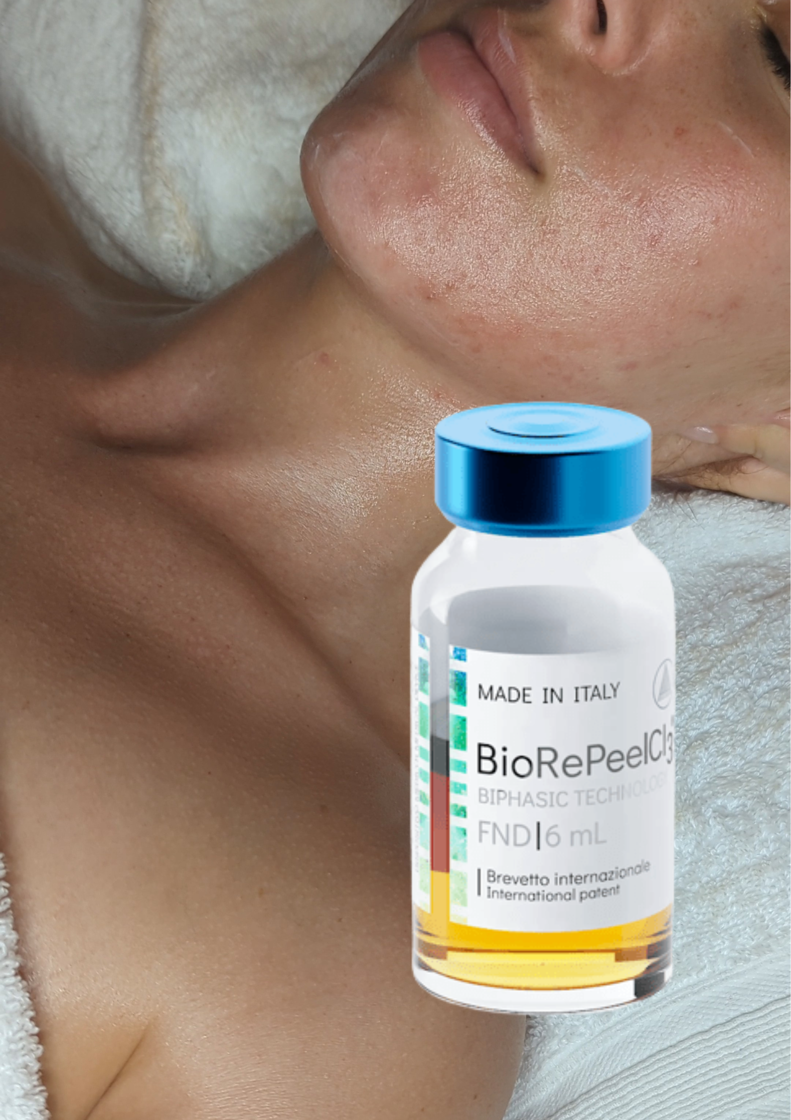 Discover The BioRePeel Facial: Now Available in Hitchin, Letchworth, and Henlow