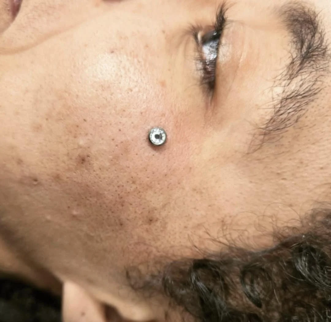 Close-up of a person's cheek with a dermal piercing featuring a small gemstone.