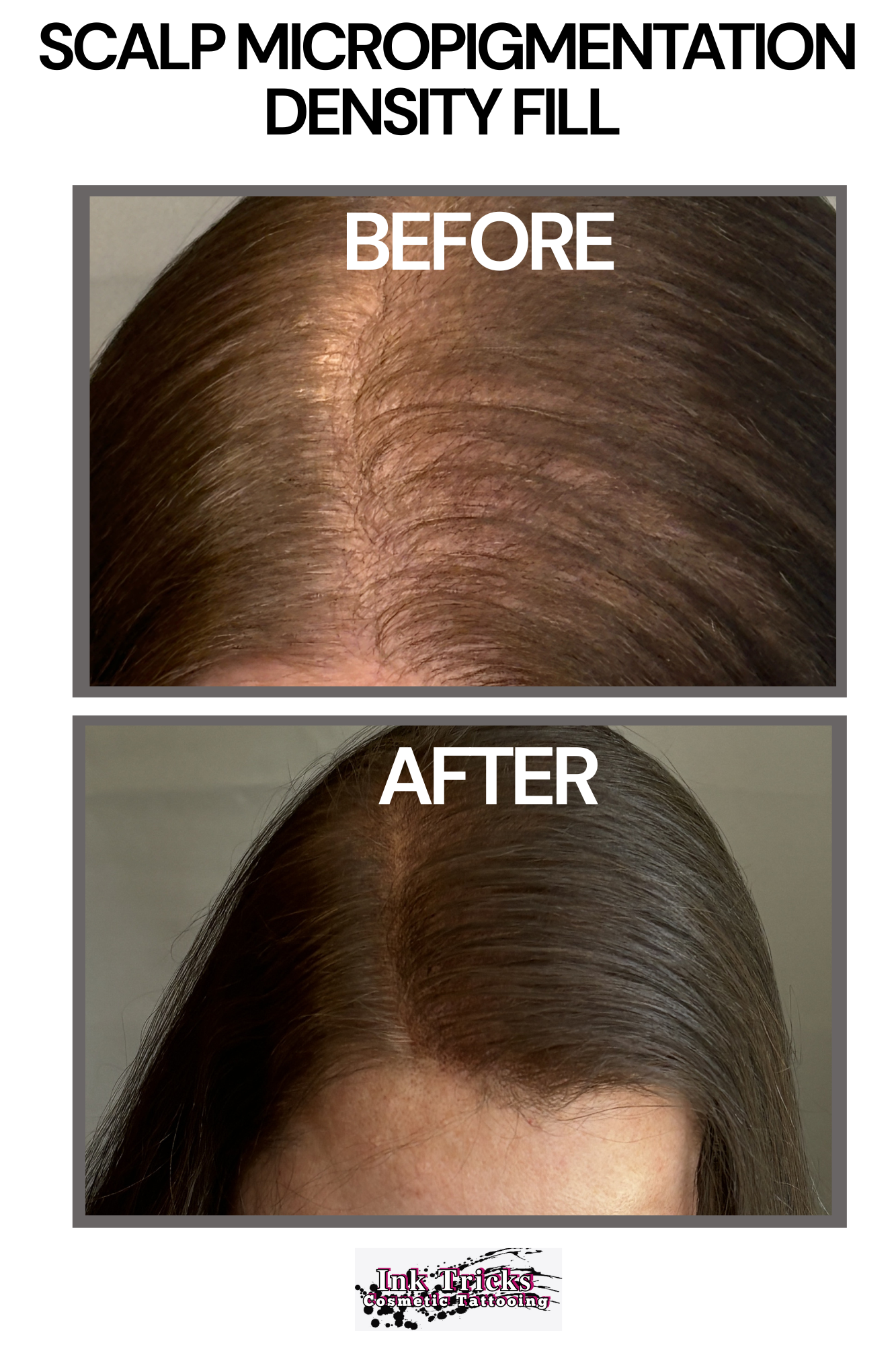 Female Scalp Micropigmentation: Part Line Density Fill.png