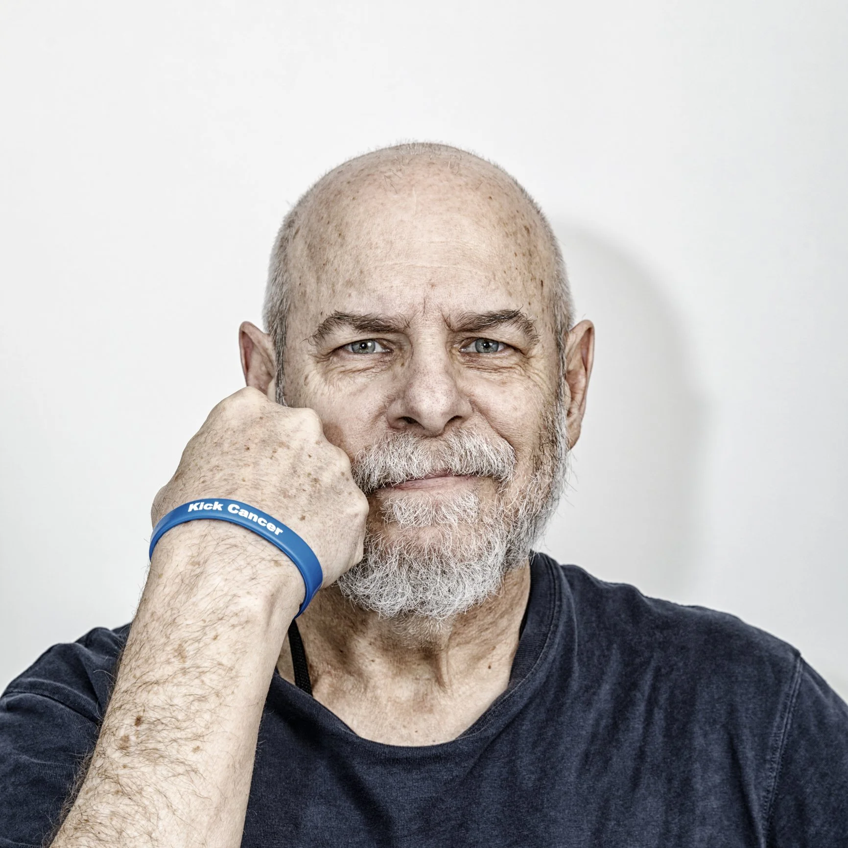 Living With Cancer on Active Surveillance: Practical and Emotional Support