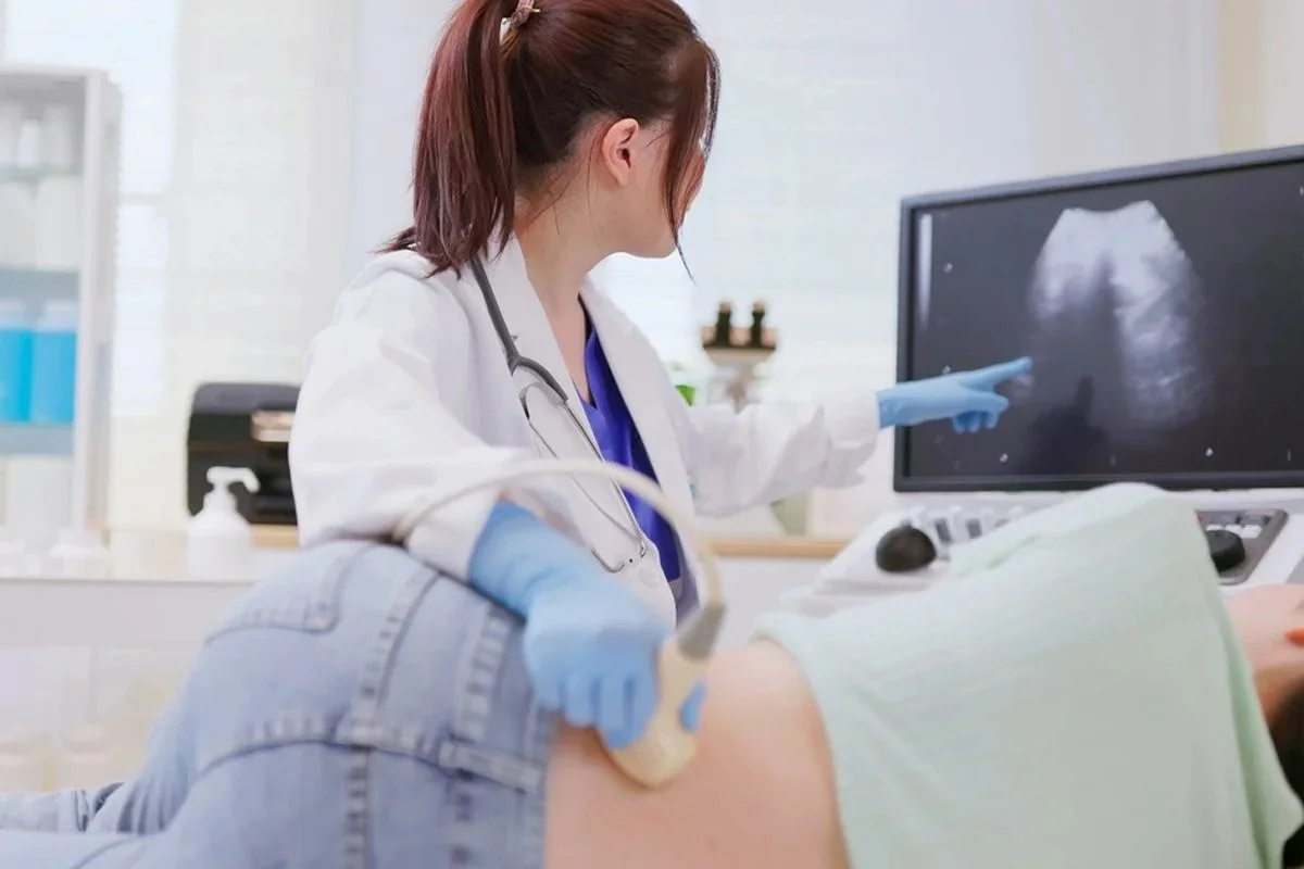 Exploring Kidney Stone Symptoms in Female Patients