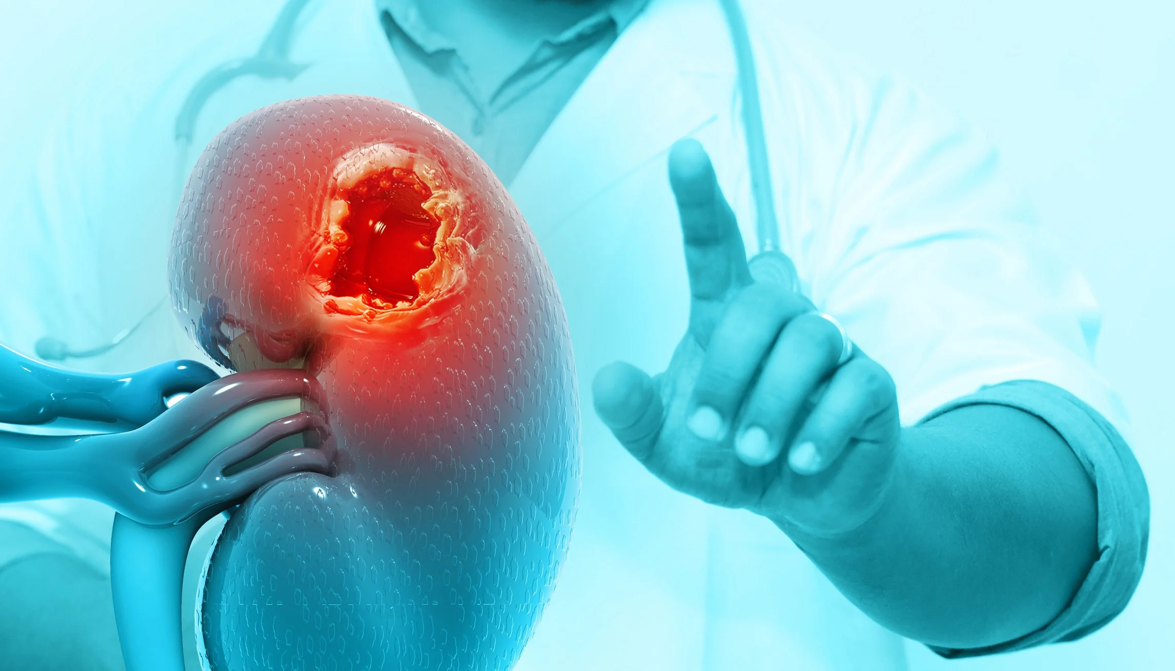 Kidney Mass Found Incidentally: What the Workup Involves