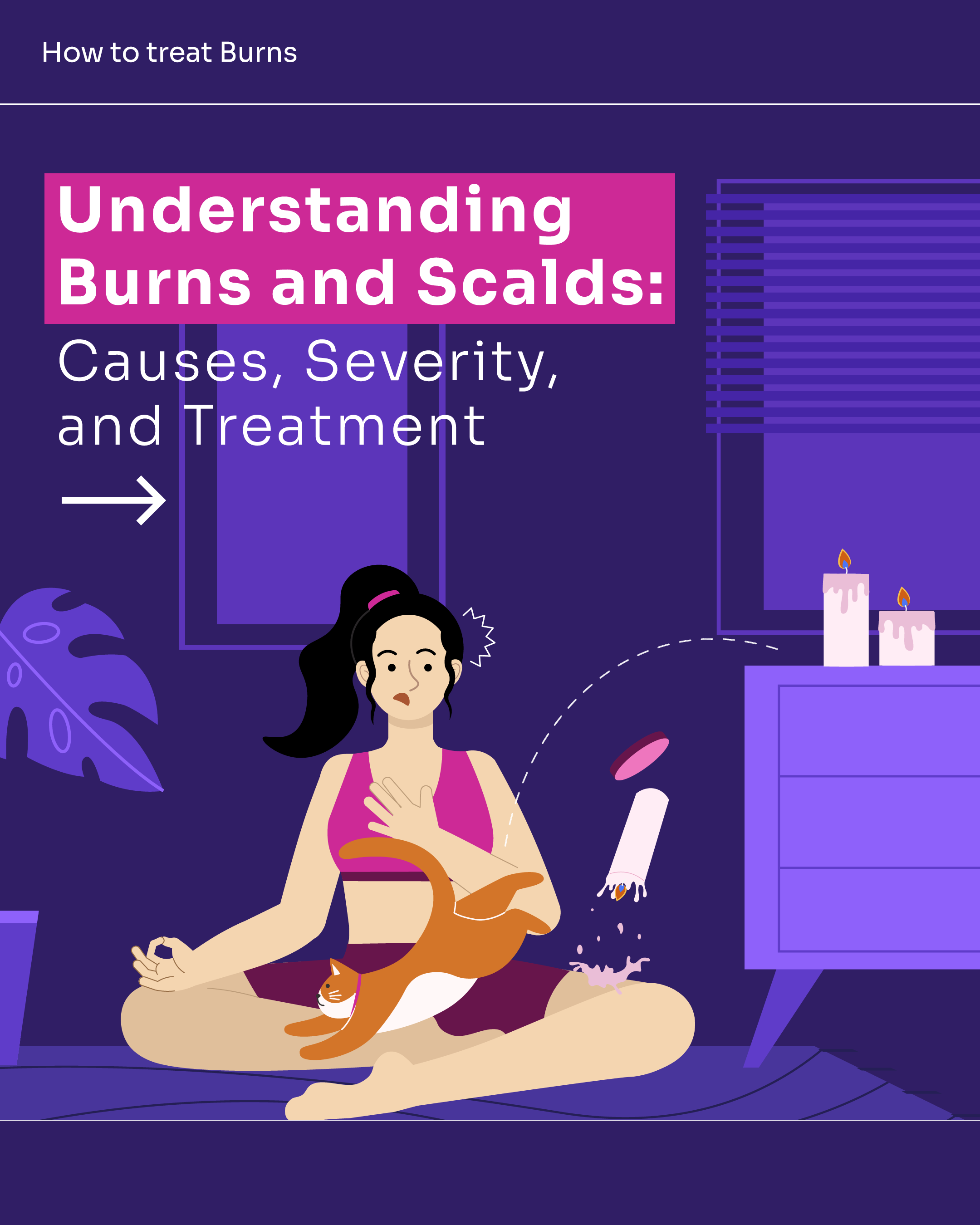 how to treat burns 1@2x.png