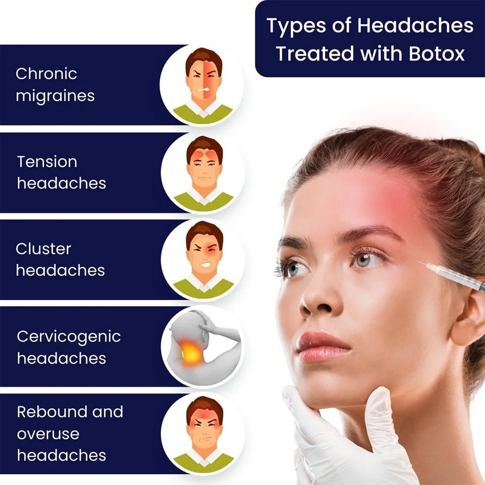 Botox for migraines and headaches at Panda Revival Lab in Surrey