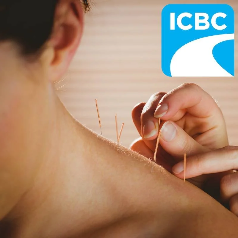 Acupuncture needles being placed in a patient's shoulder with the ICBC logo, showing acupuncture is covered for ICBC claims
