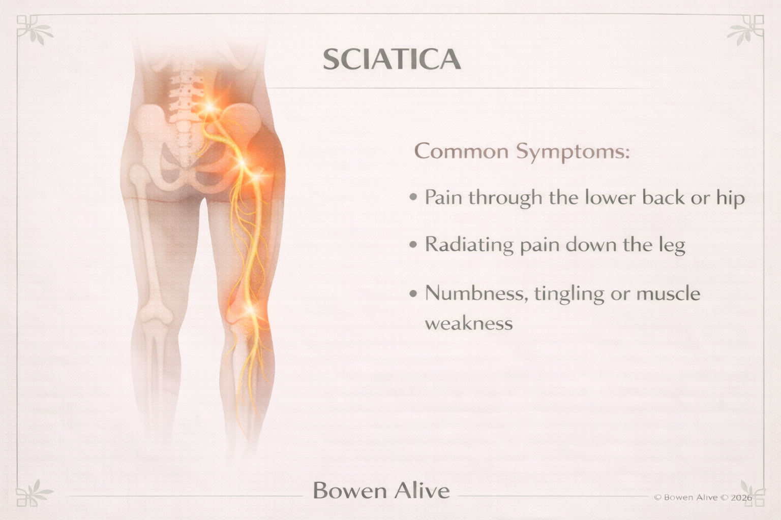 Bowen Therapy for Back Pain and Sciatica