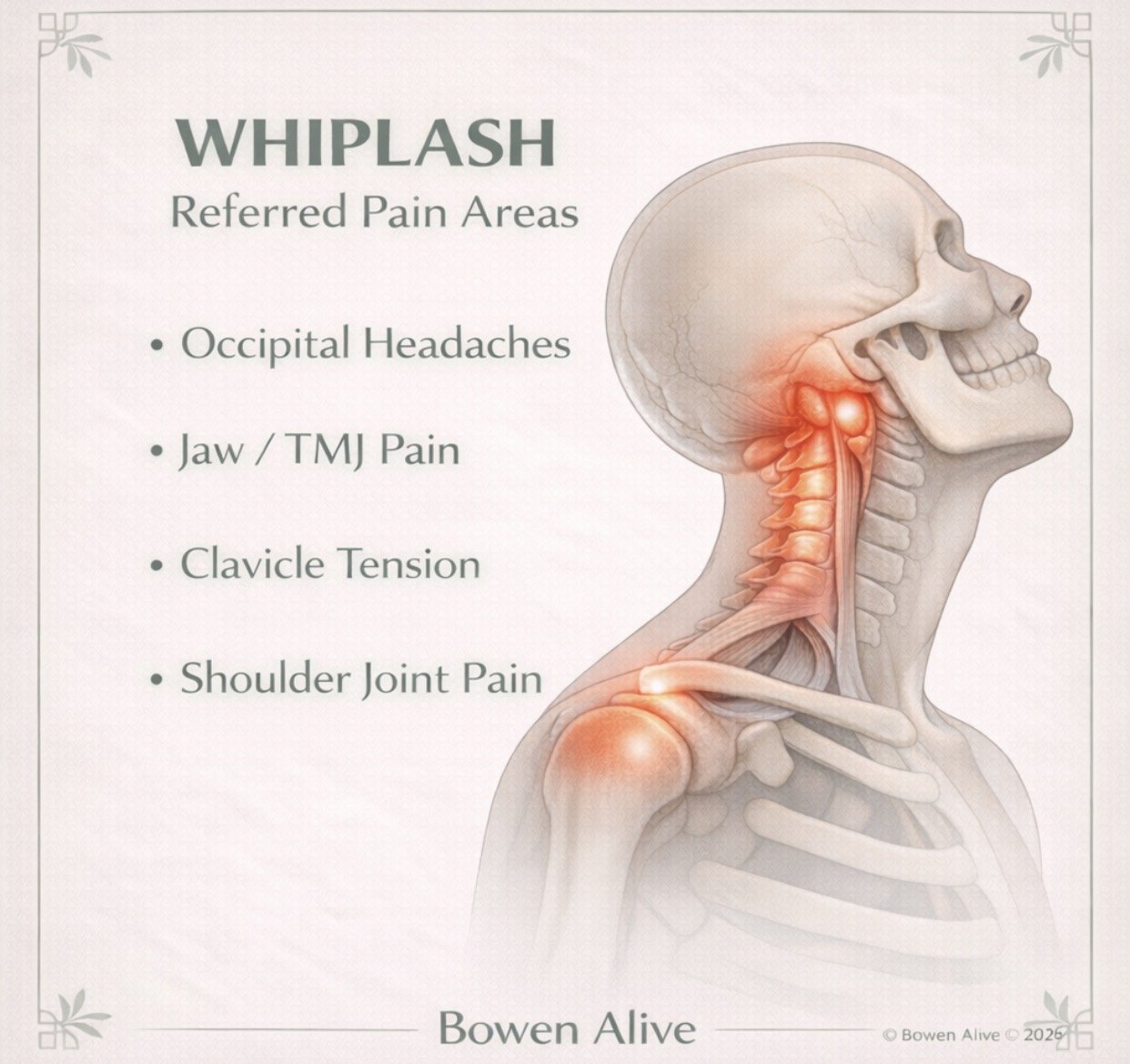 Sarah Dwyer Bowen Therapist Treats Concussion Whiplash Injury
