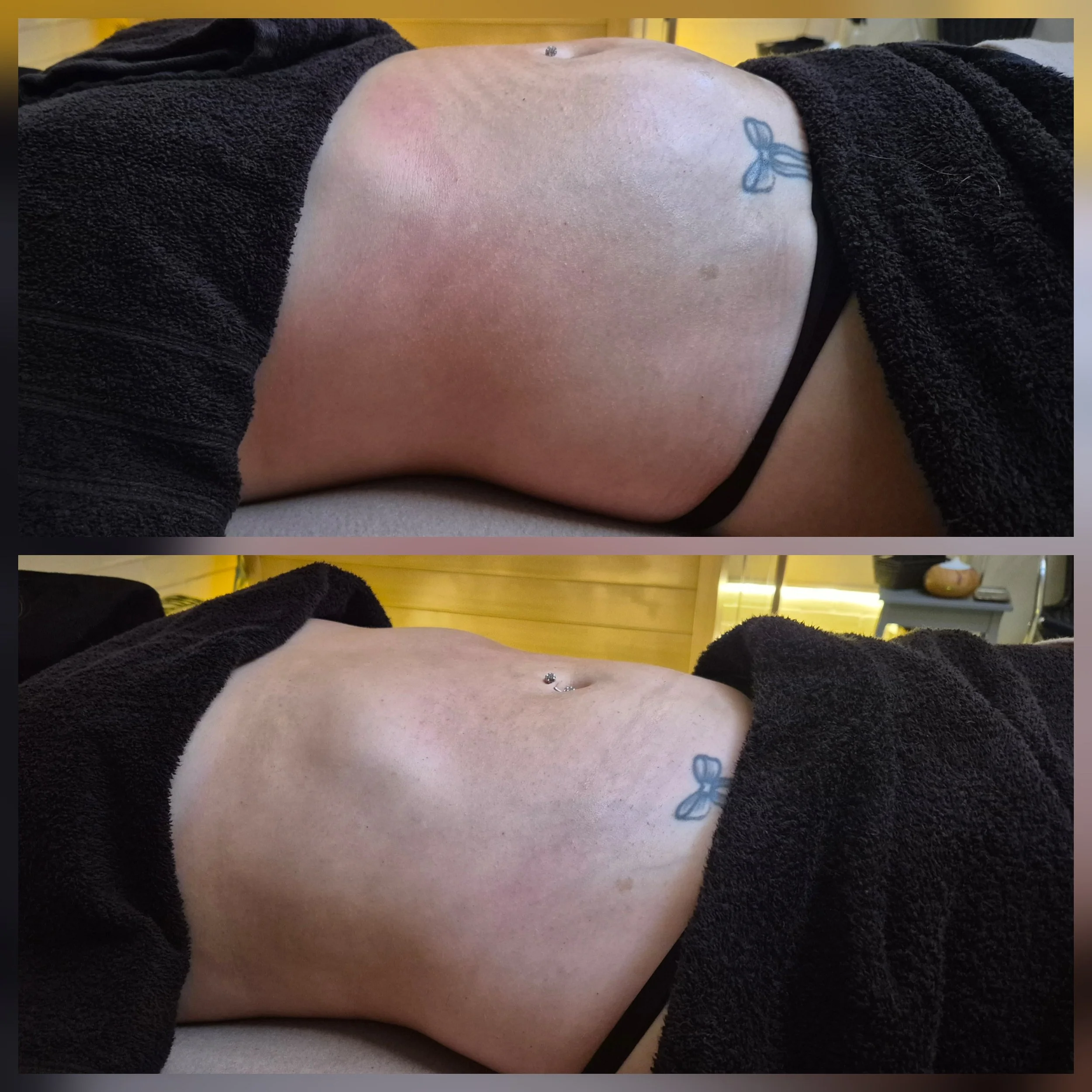 lymphatic drainage massage body contour massage Deal Kent