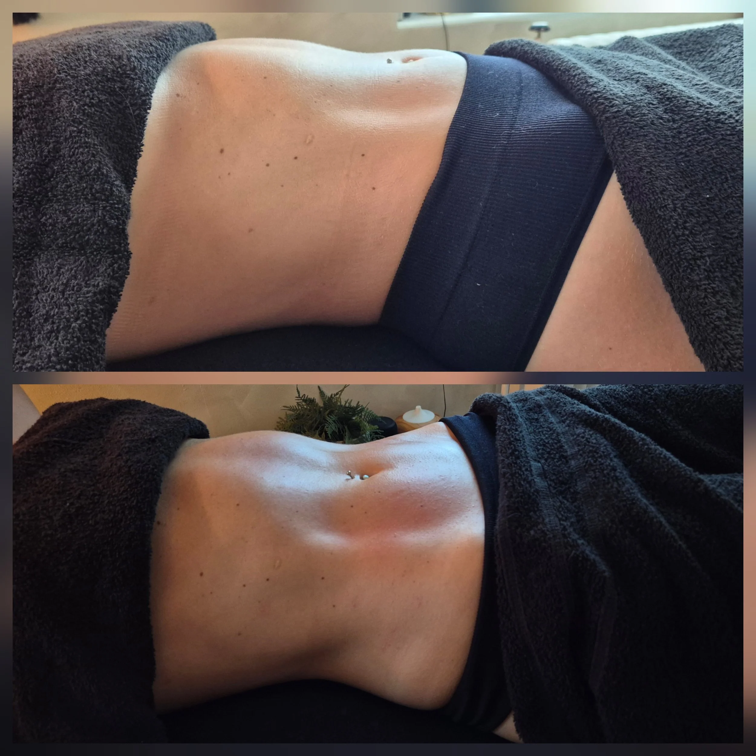 lymphatic drainage massage body contour massage Deal Kent