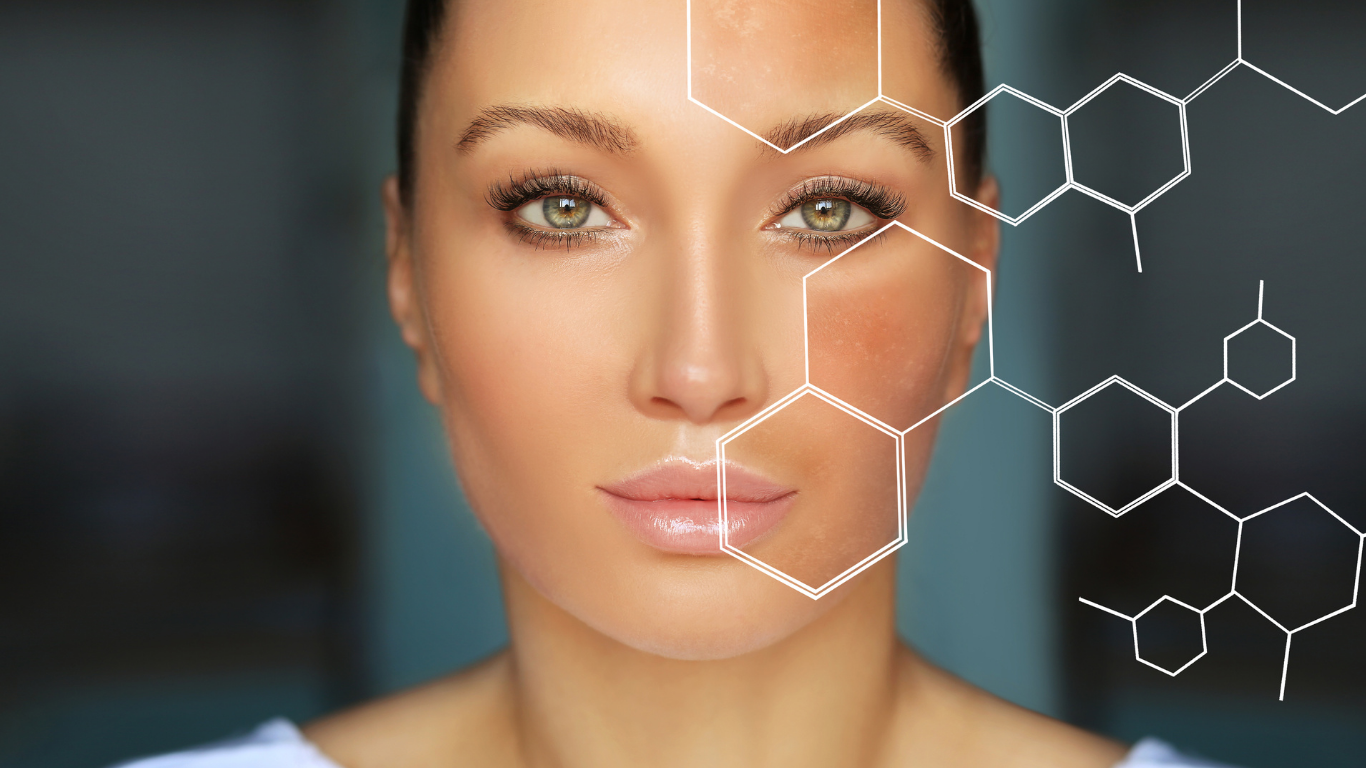 Why Red Light Therapy Isn’t Safe for Melasma