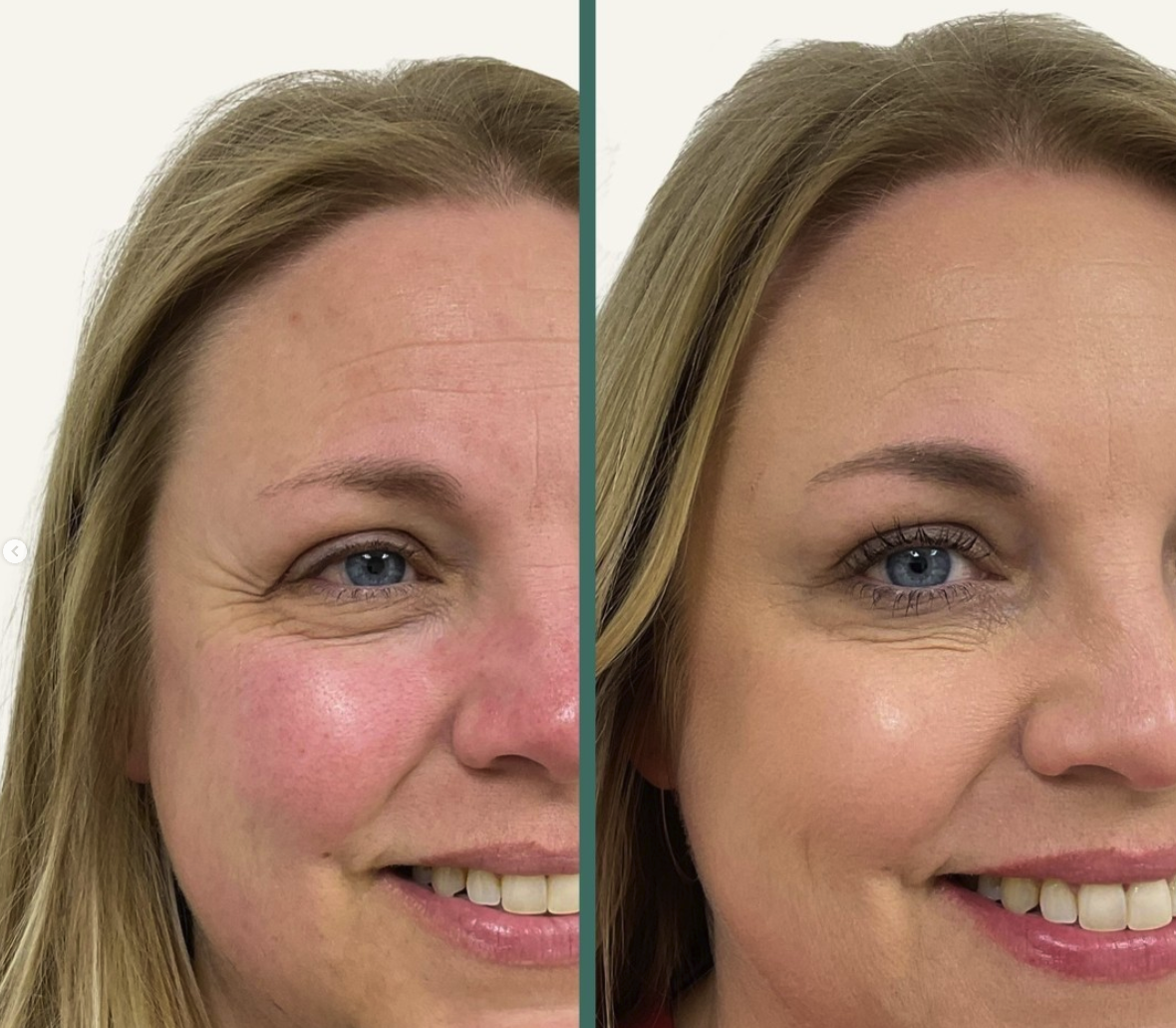 Screenshot 2025-03-06 at 2.54.17 PM.png