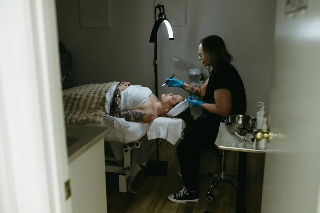 a chemical peel treatment nin Calgary, AB