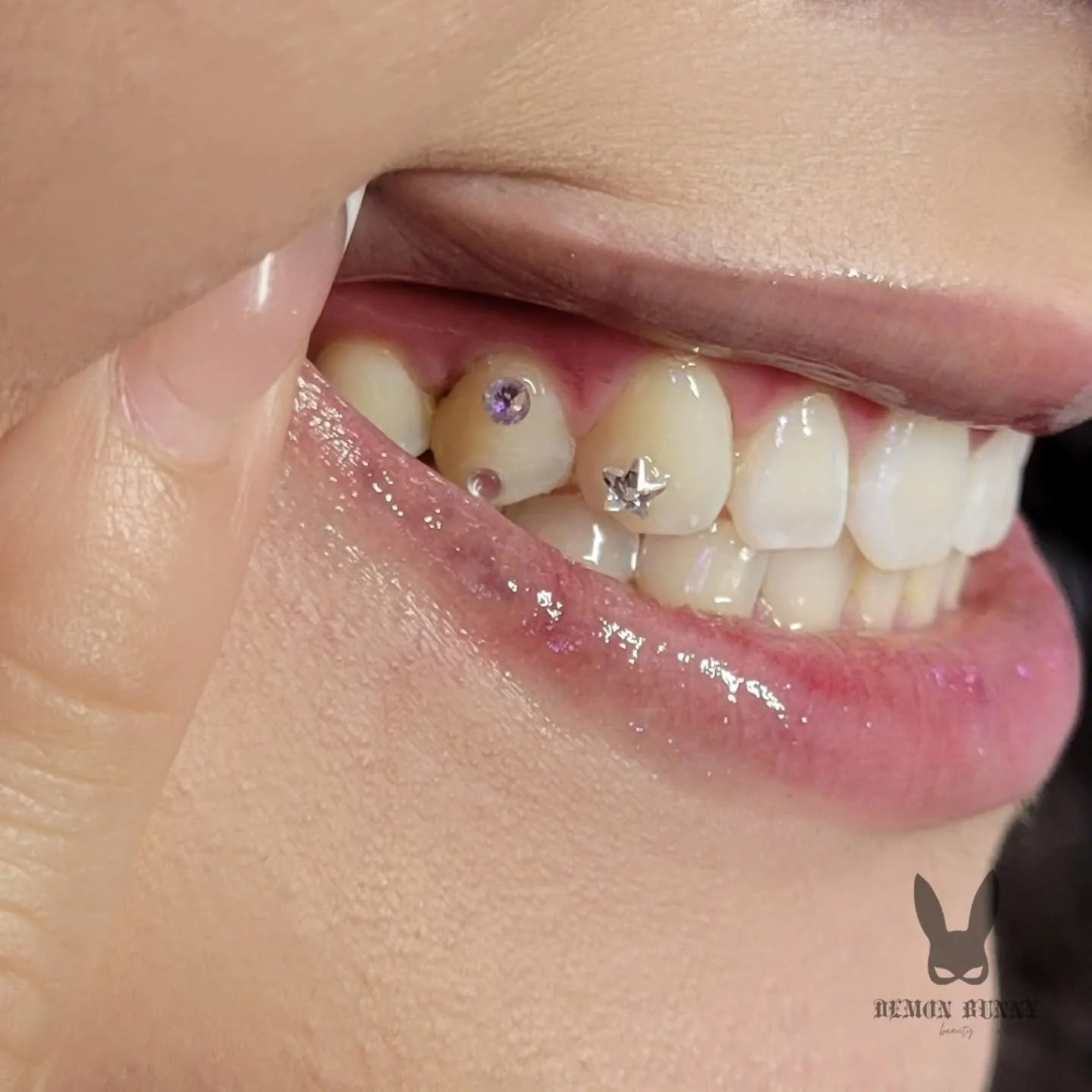 🦷💎

This was a fun tooth gem set I did a few weeks back! If you have a wire retainer, bring it in to your tooth gem appointment.  We can place the gems around your retainer to help give them longevity and stay out of the way while you maintain your