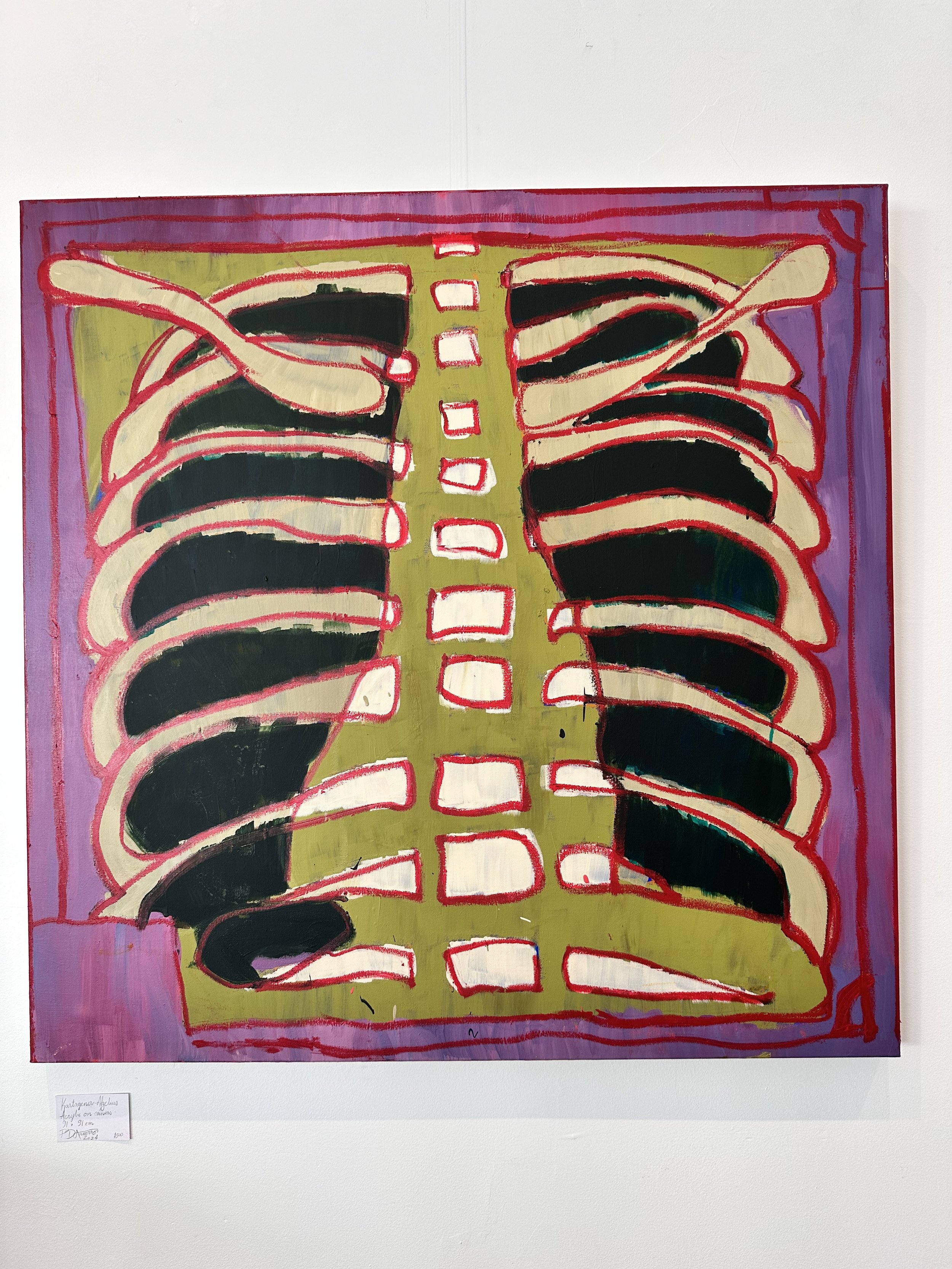 Situs Inversus