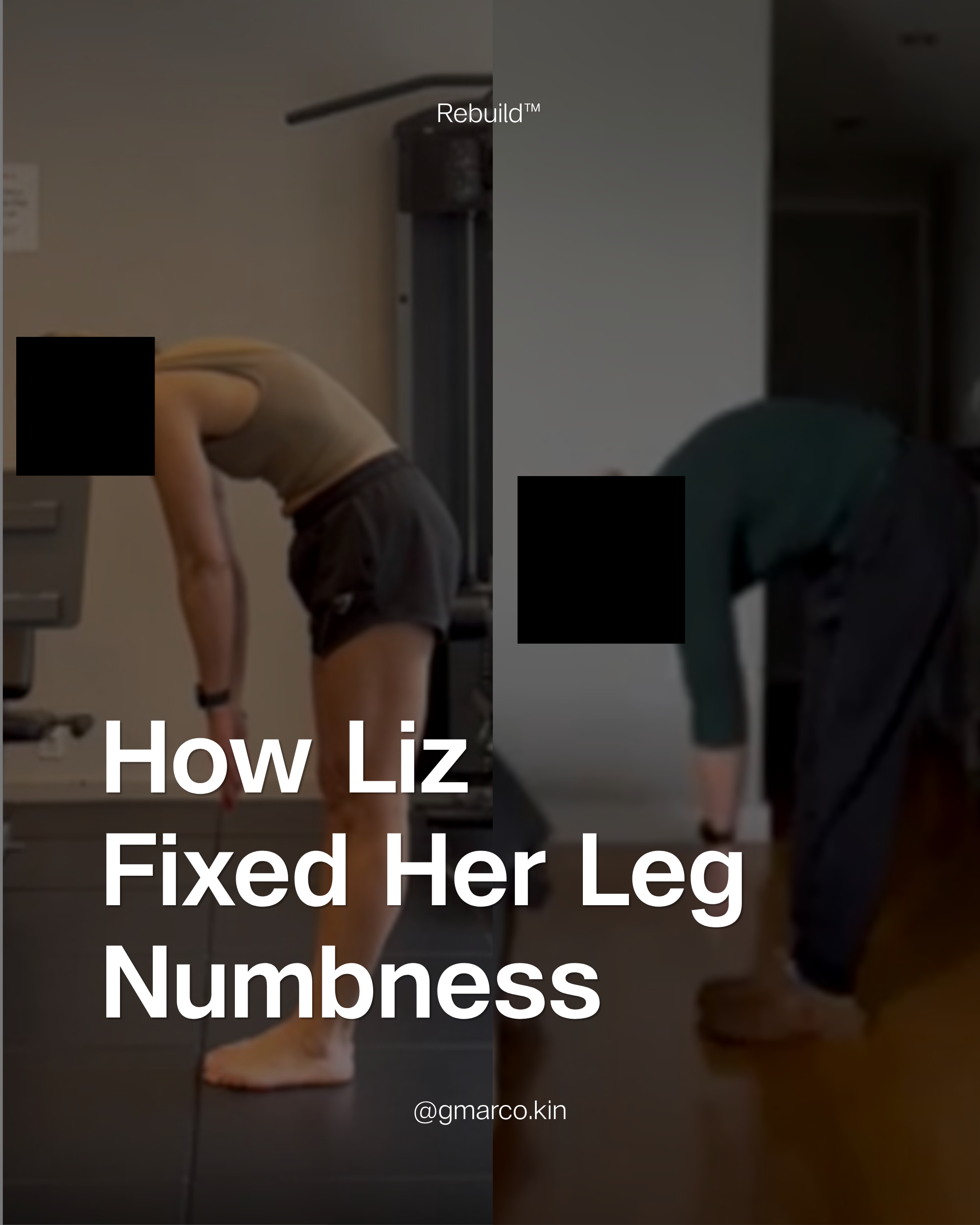 4 months of leg numbness. Gone.
