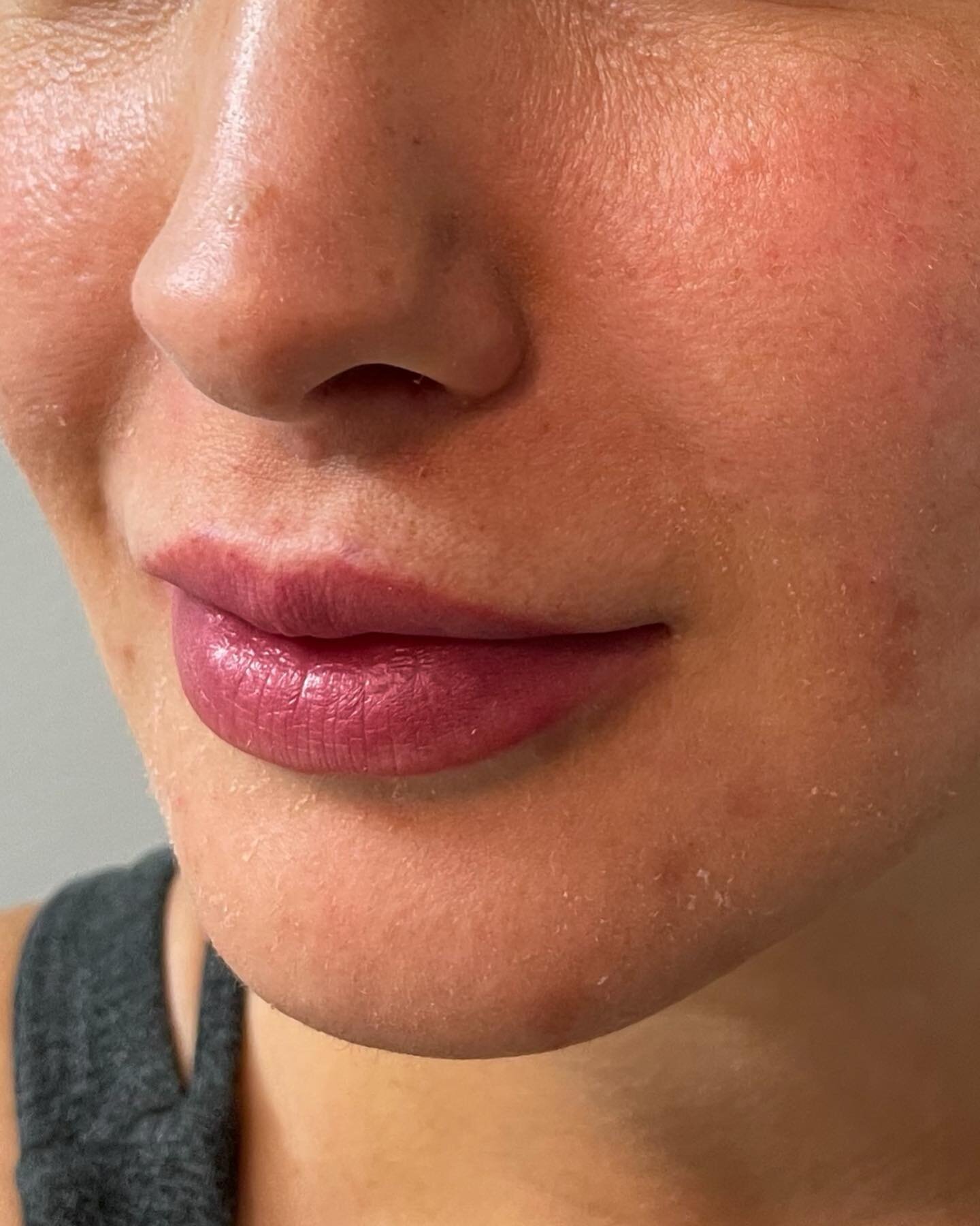 A little lip blush goes a long way ✨

DM to book your appointment today! 

#pmuartist #lipblushing #lipblushtattoo #atlantapmu #cosmetictattooing #cosmetictattooartist #lips #makeupartist #alpharettamakeupartist #liptattoo #permanentmakeup