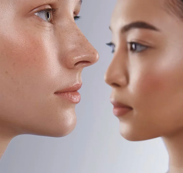 Microneedling vs Chemical Peels: Which Is Better for Acne Scars?