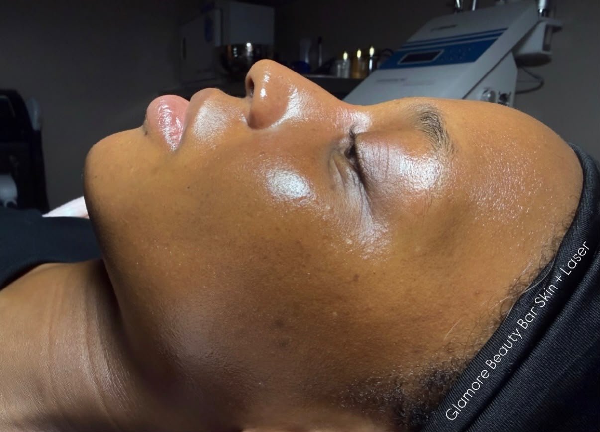 custom facial.jpeg