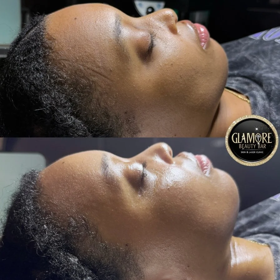 ethnic skin before after.jpeg
