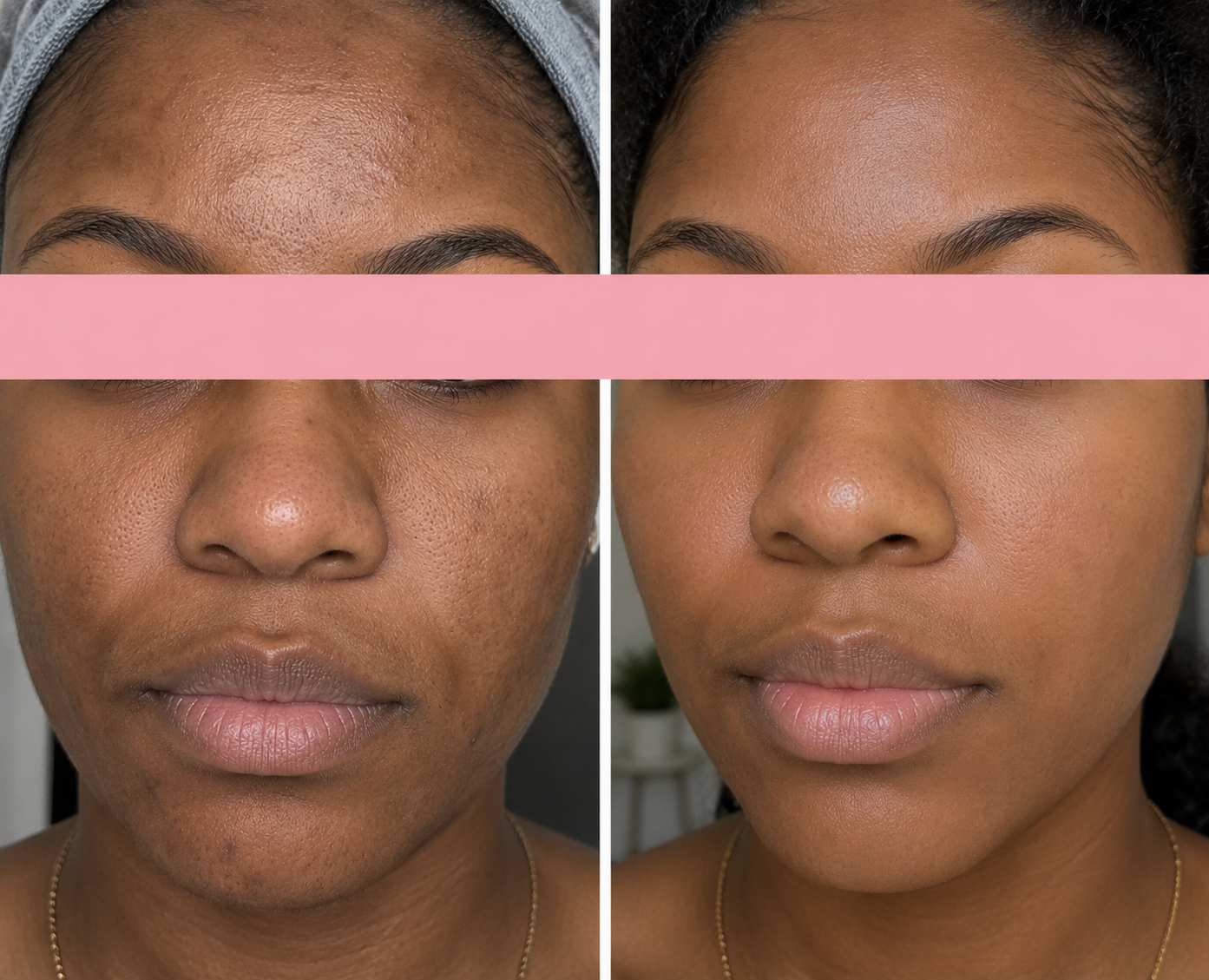 uneven skin texture before and after.png