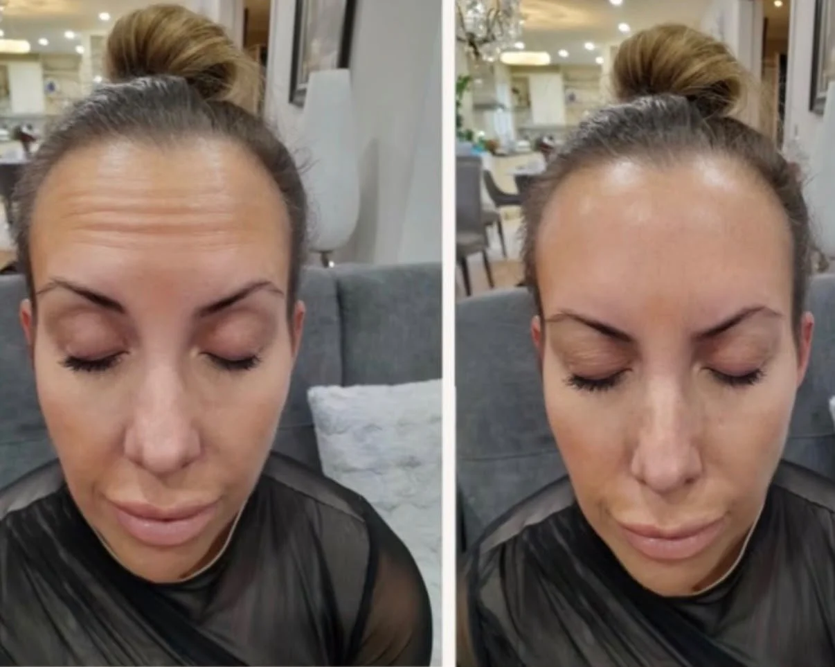 The New Face of Injectables: Filler, Sculptra, Botox &amp; the Art of Facial Balancing