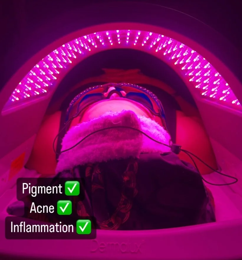 LED light therapy treatment used to repair damaged skin barrier and reduce inflammation