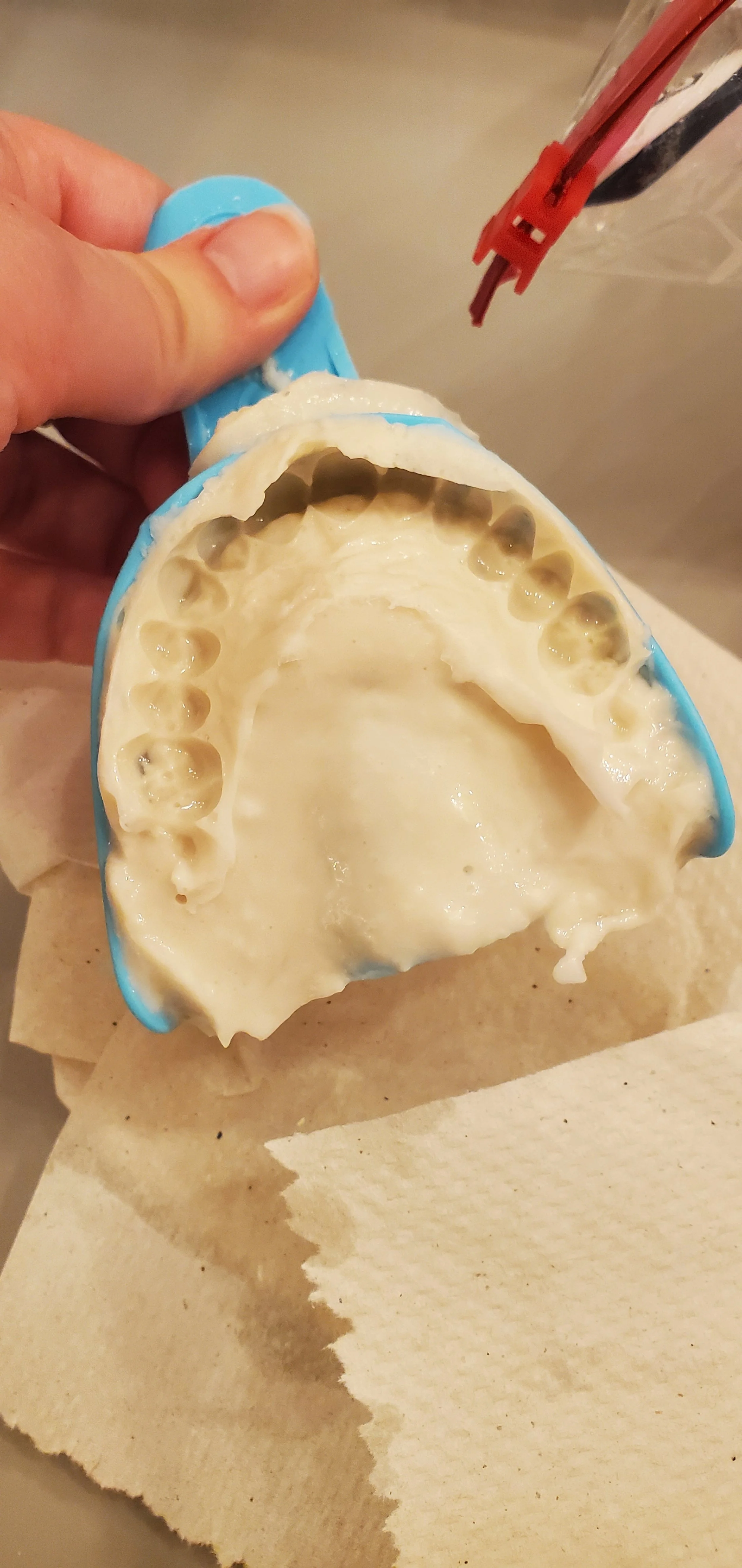 Mold of my top teeth