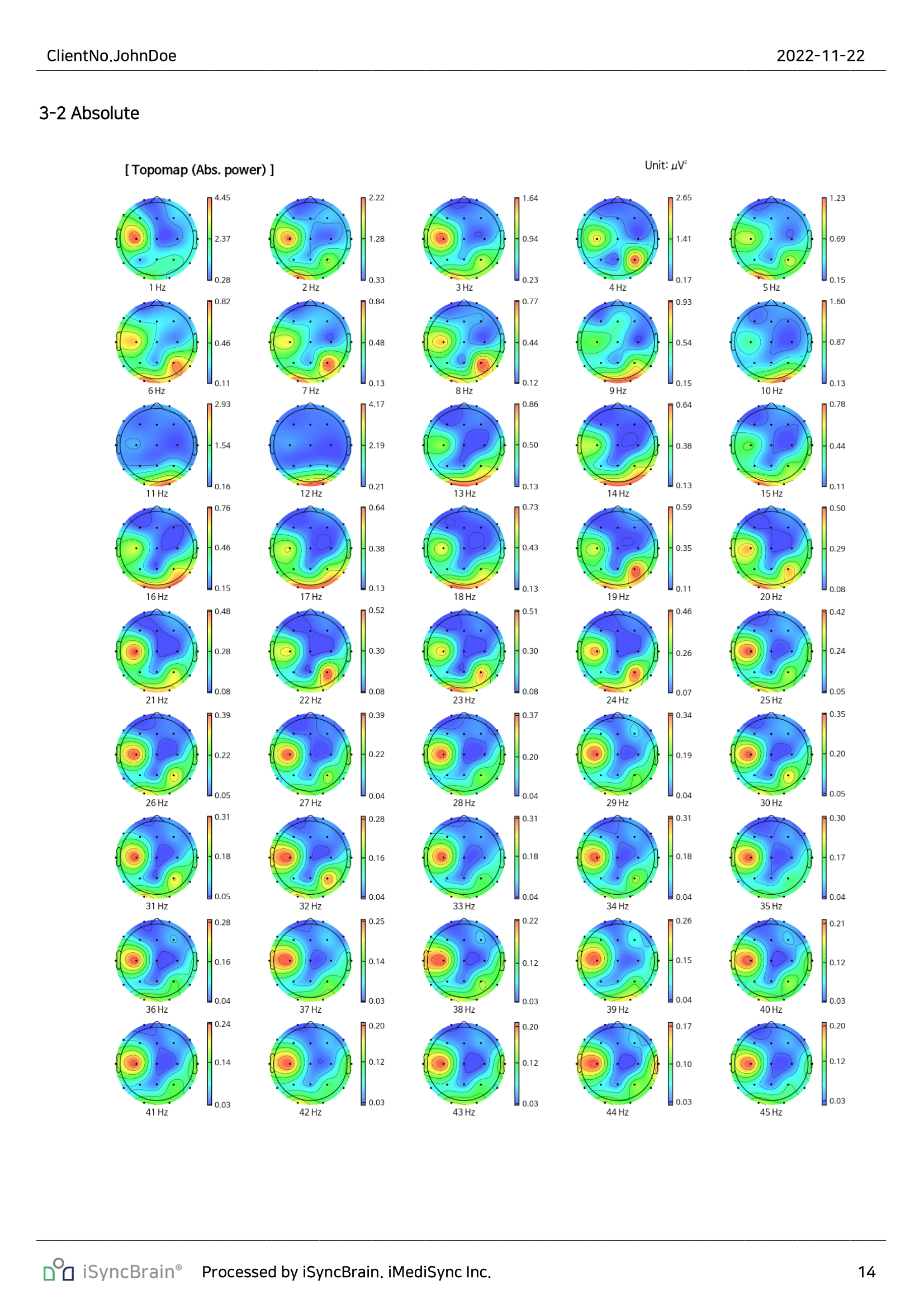 Band Power – Topomap
Visual maps of absolute and relative power across brain regions in 1 Hz Bins