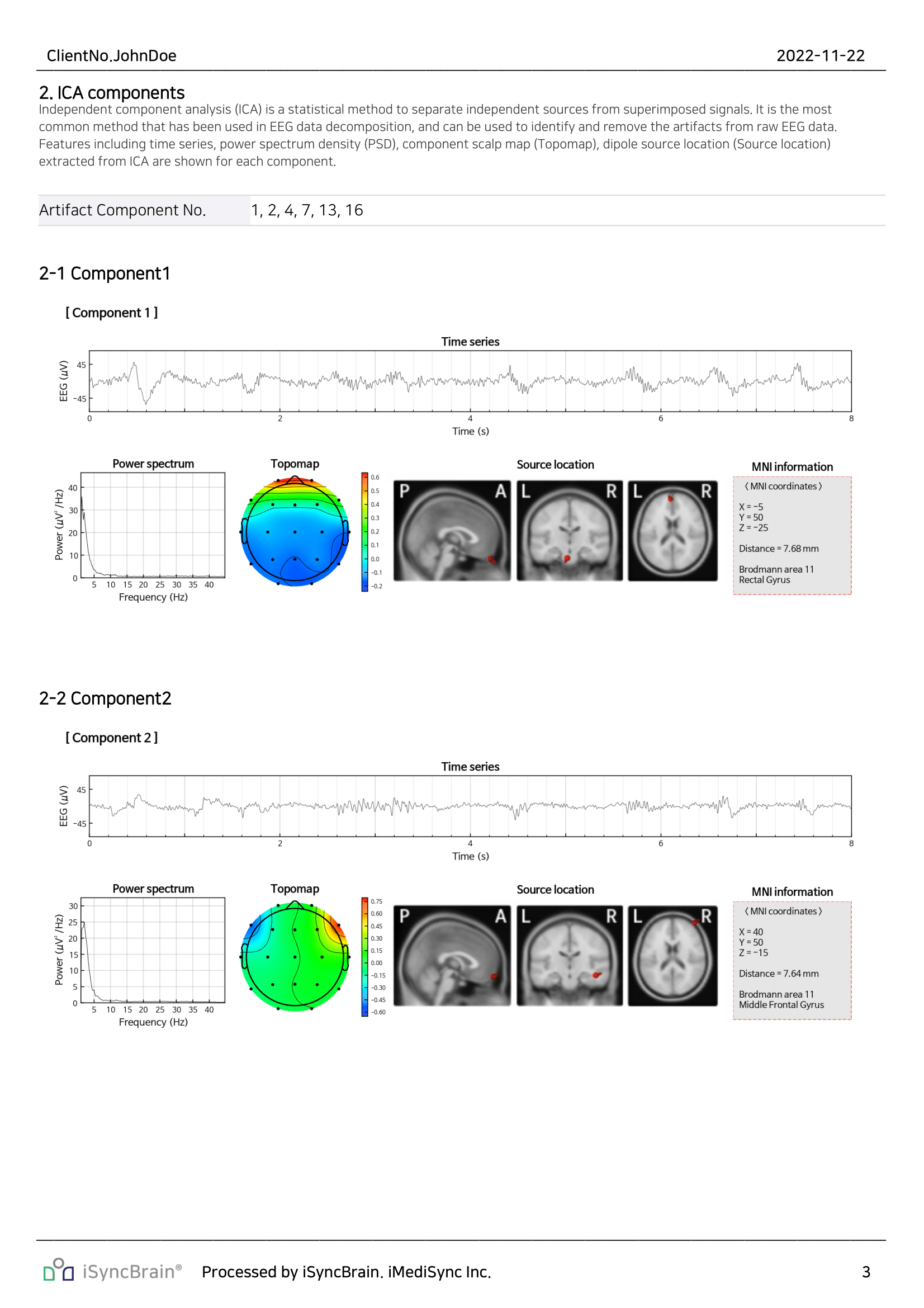 ICA Components
Breaks down EEG into independent sources to isolate noise and underlying brain signals.