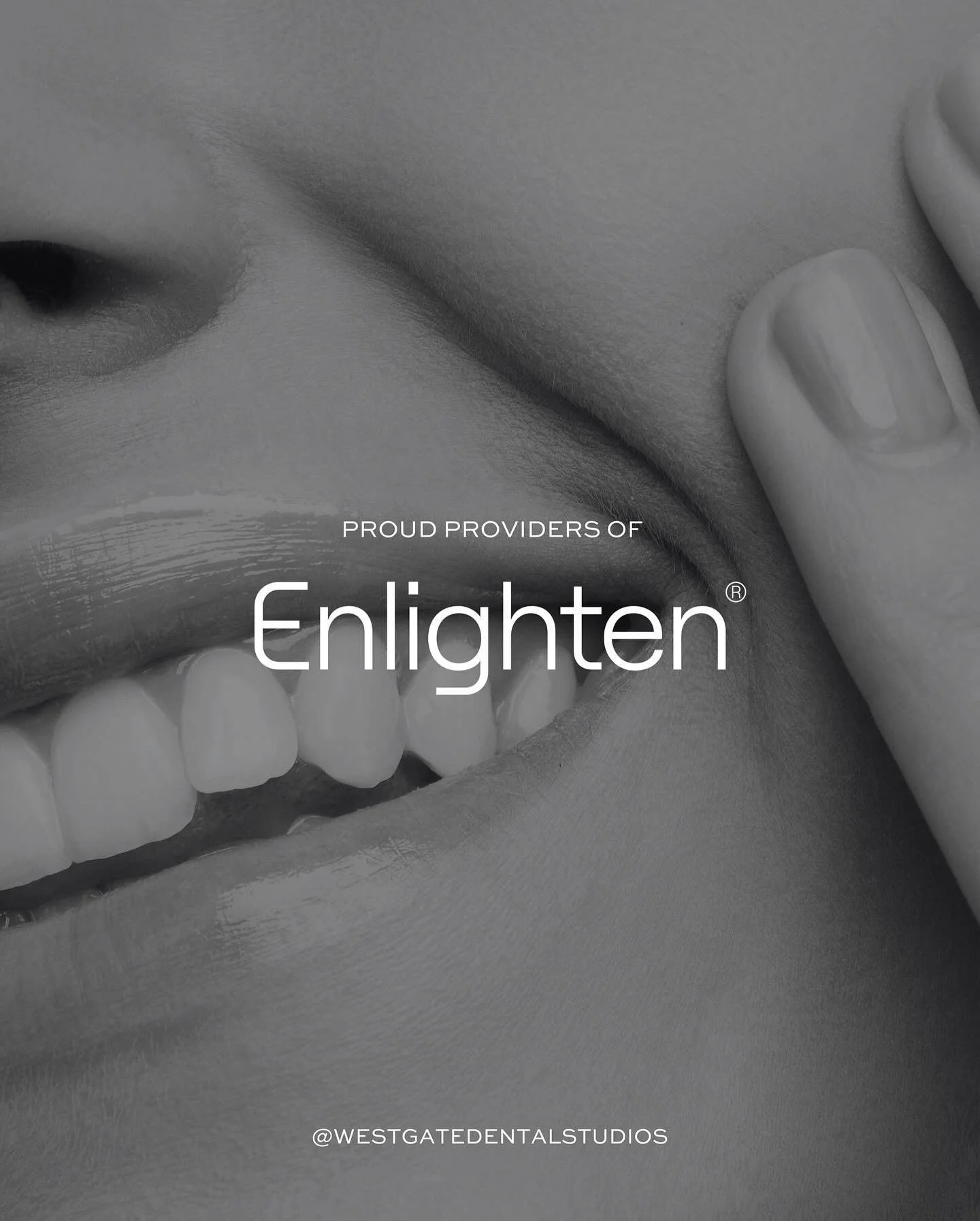 🌞✨ Thinking about brightening up your smile for summer? We’re excited to announce an amazing offer on Enlighten tooth whitening! ✨🌞
Get the full Enlighten tooth whitening package, a scale and polish, PLUS an air polishing treatment! 🦷✨
And