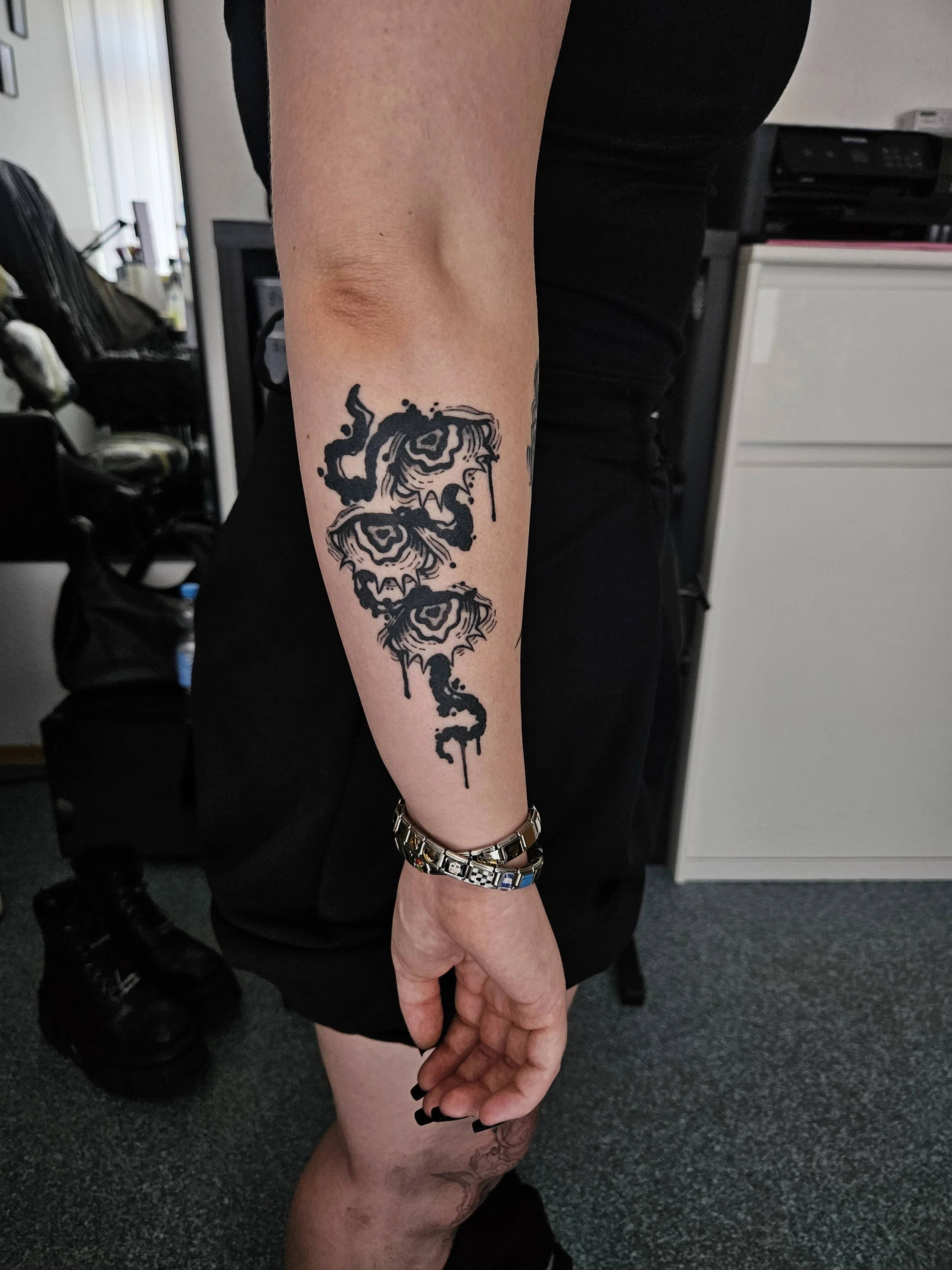 2 Months healed