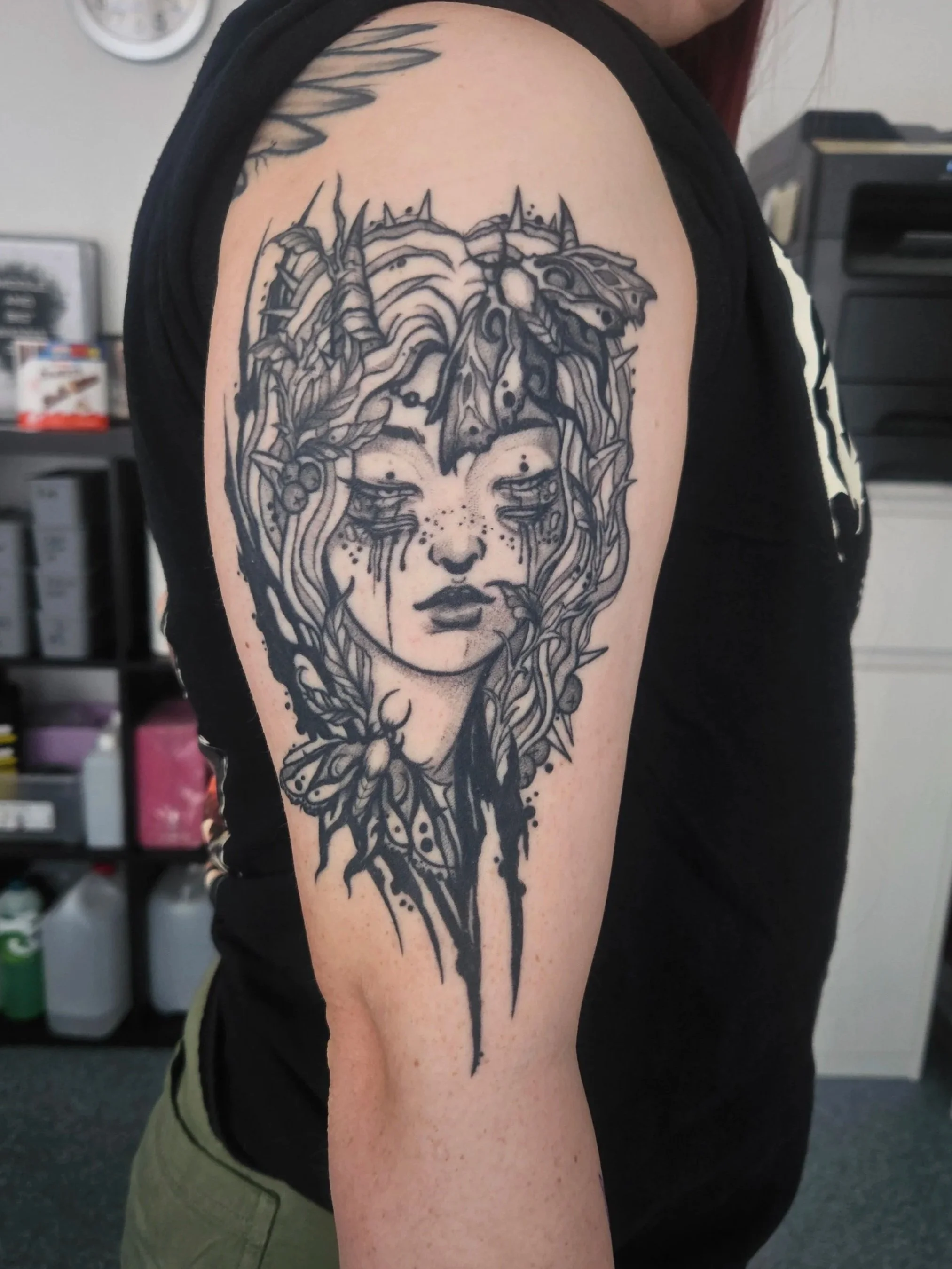 8 Months healed