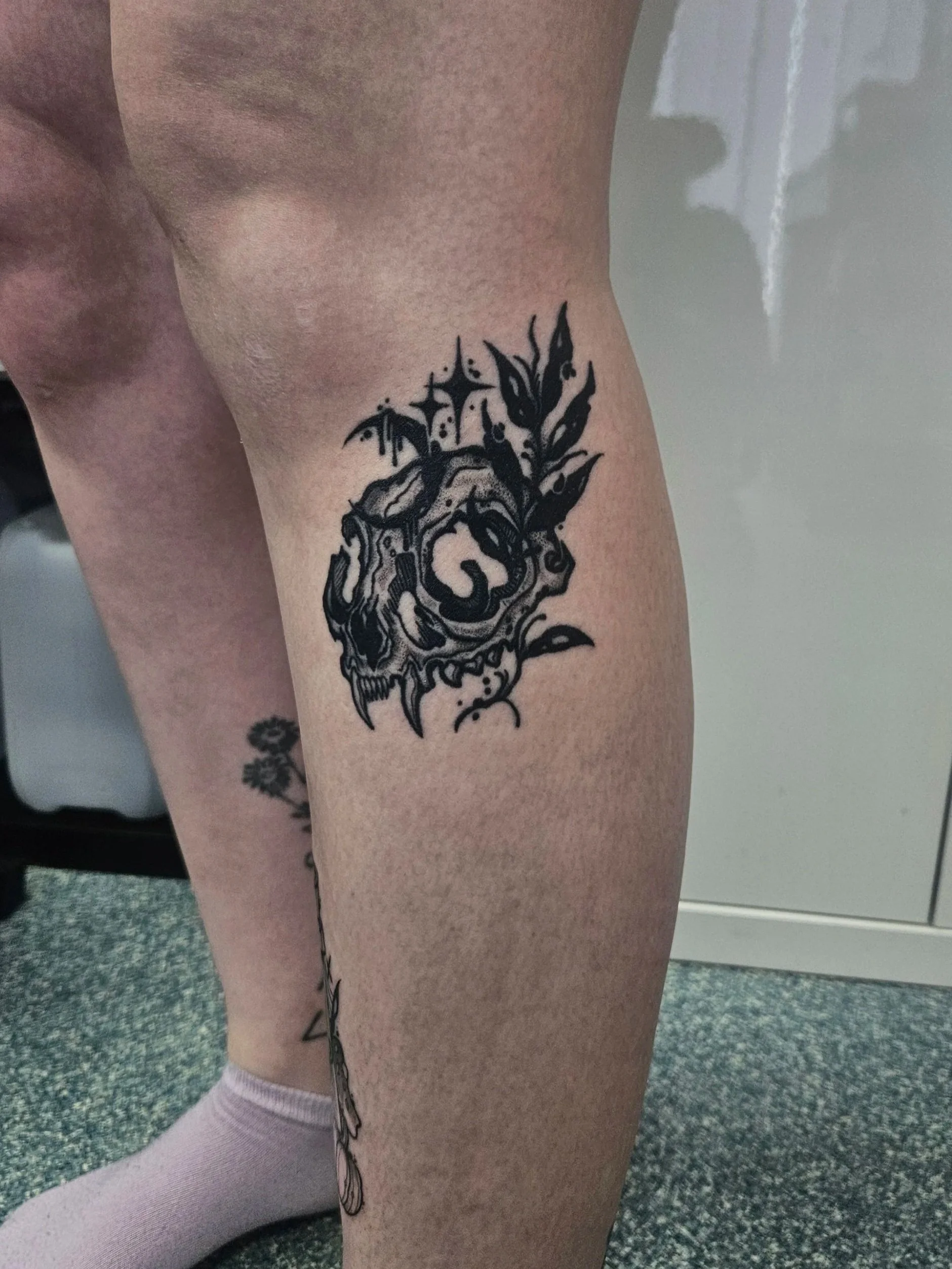 1 year healed