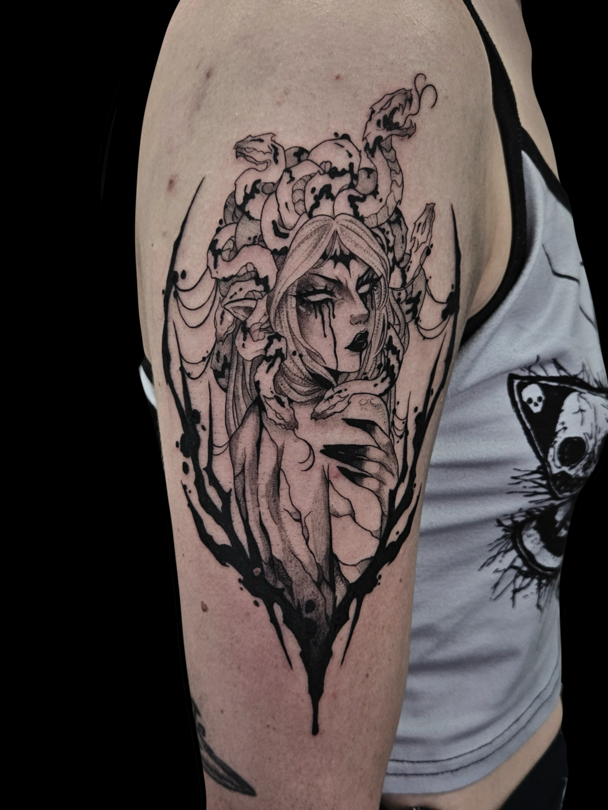 Medusa