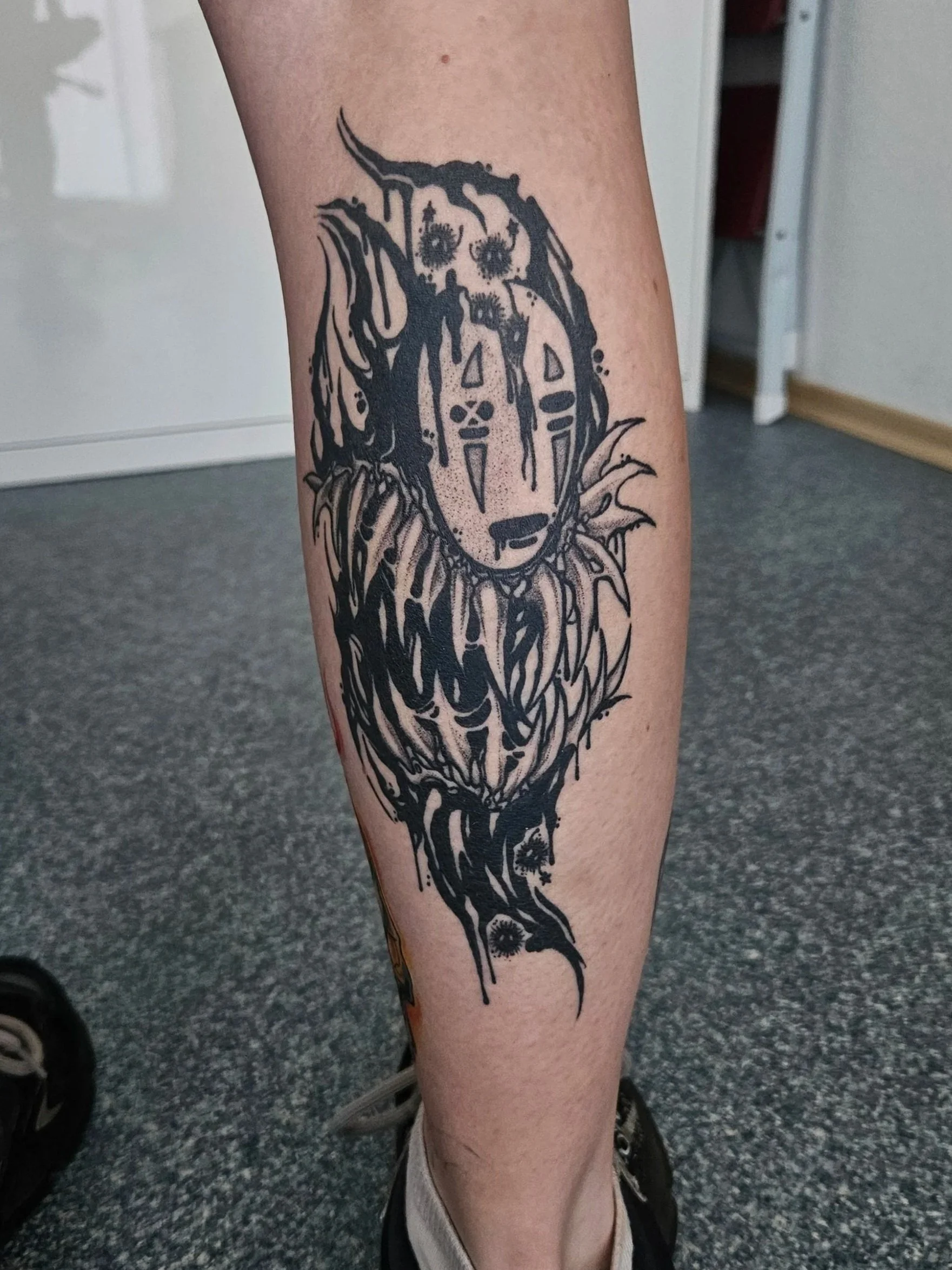 1 Year healed
