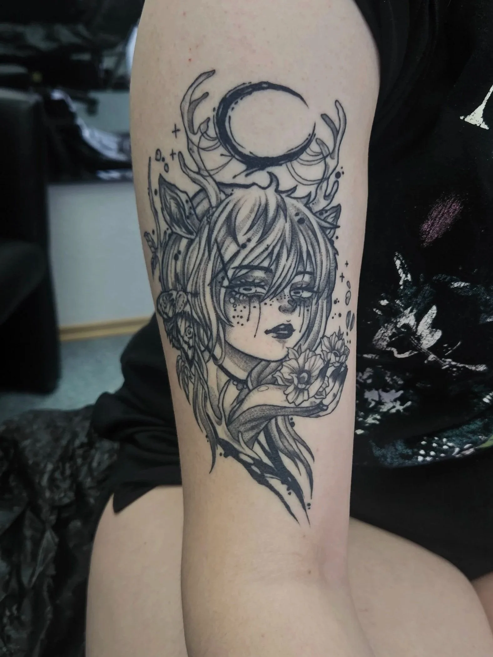 1 Month Healed