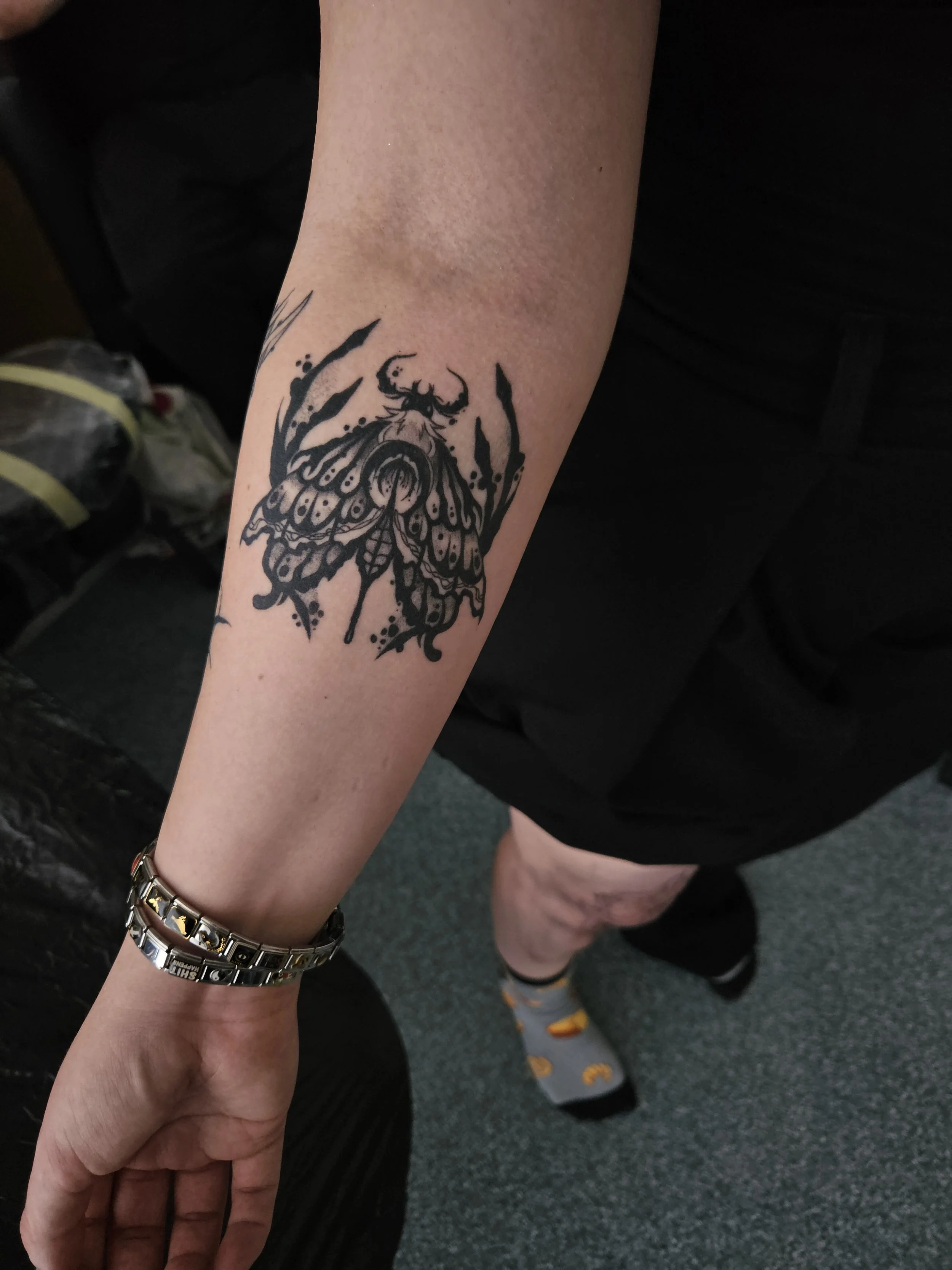 3 Months healed