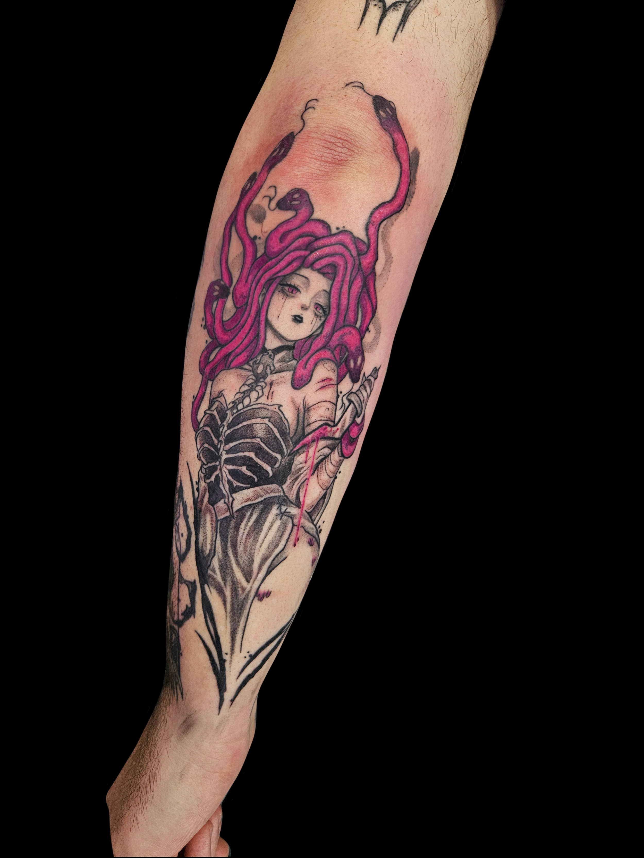 Medusa