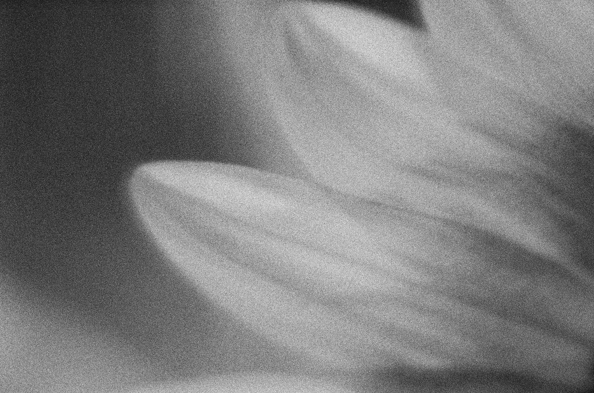 A grainy black and white close-up of a person's face, with the eye partially visible on the right side of the image.