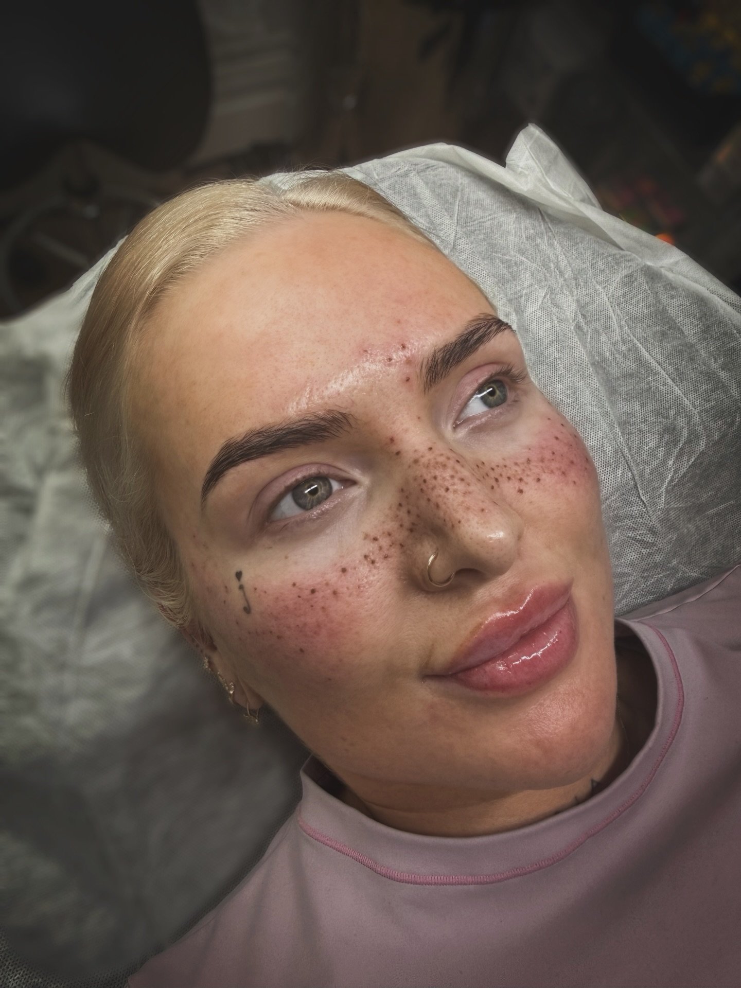 ✨ Final session on the beautiful Em, adding some dimension to her hyper realistic sprinkle of freckles ✨
.
These gorgeous sunspots will lighten by about 40% in 4-6weeks once healed, giving a perfect naturally sun-kissed effect.
.
DM to book yours x
.