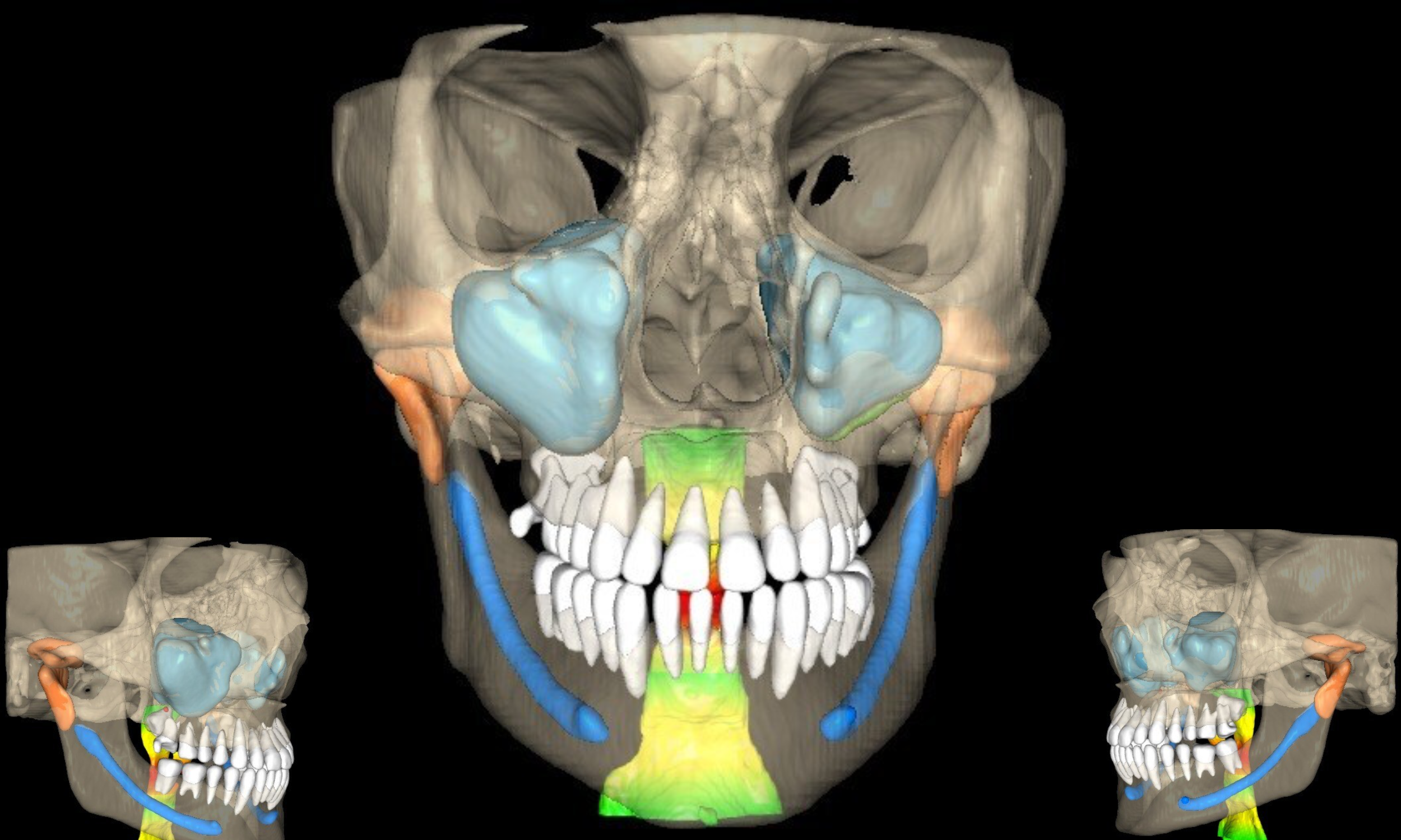 VELMENI Receives FDA Clearance for AI-Powered 3D Dental Imaging Software