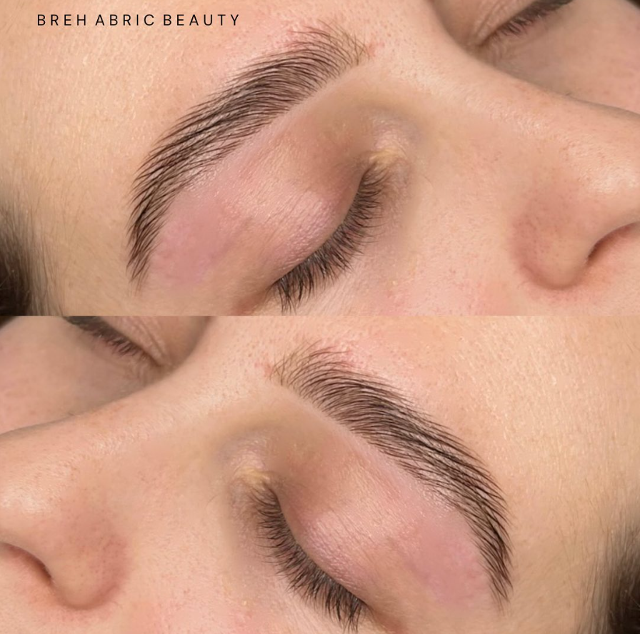 Close-up of a person's closed eye showing well-groomed eyebrow and smooth skin, possibly after a beauty treatment.