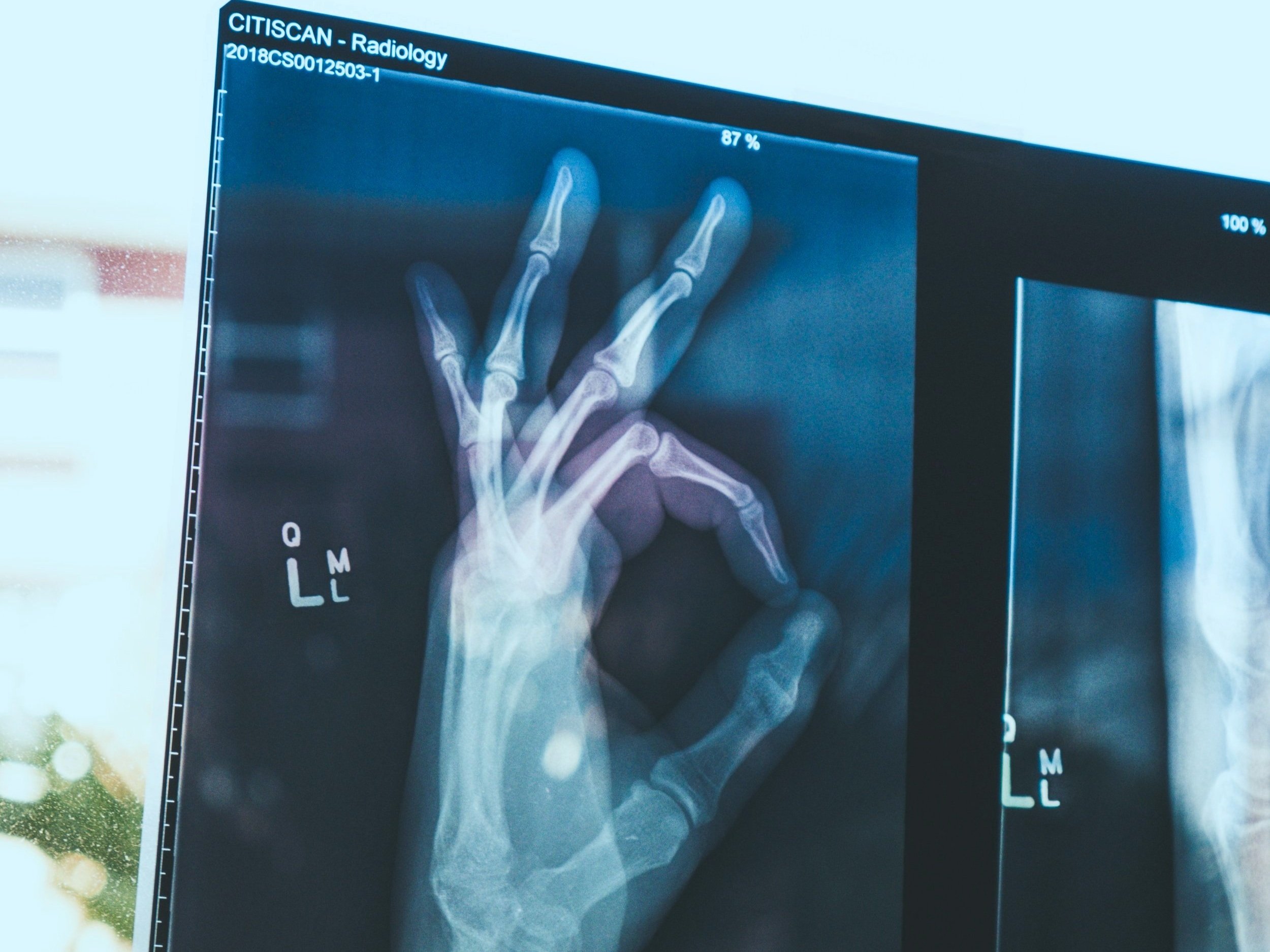 Disability Cover and why you need it.