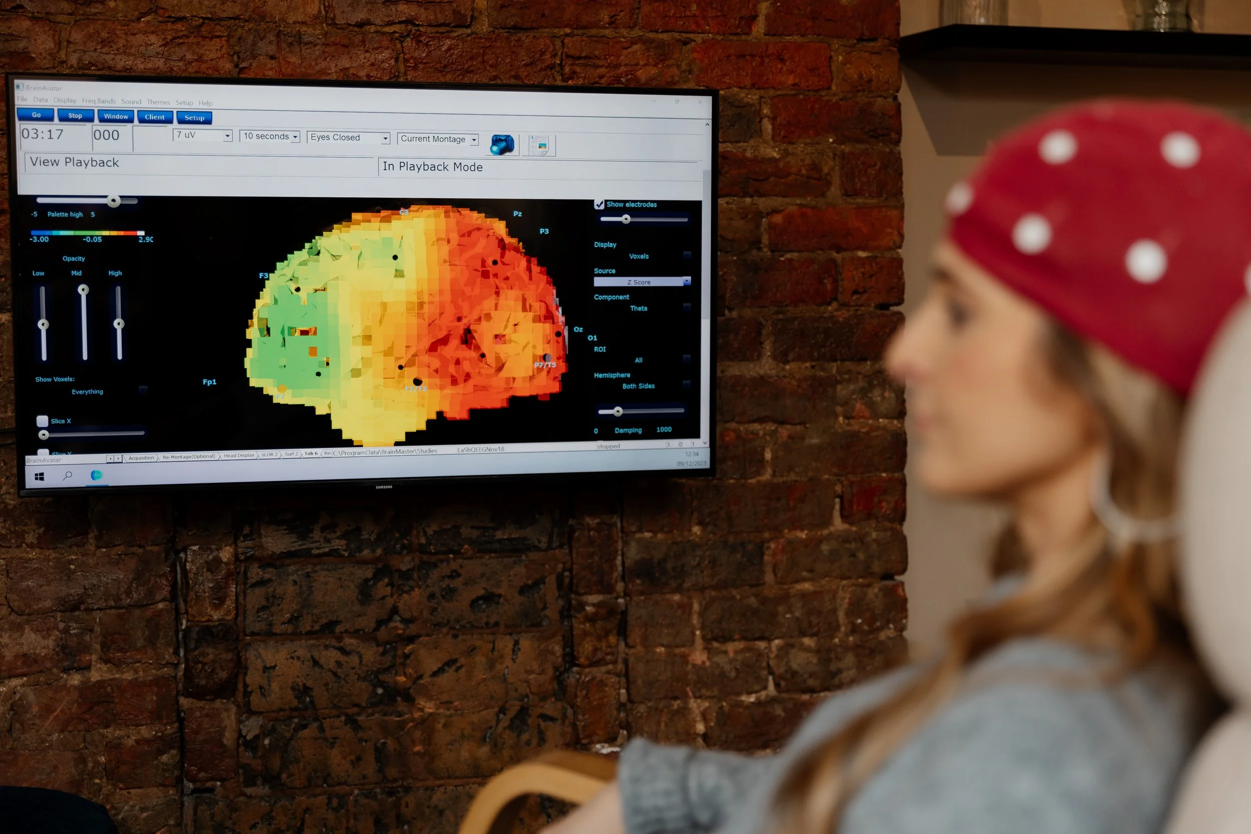 QEEG Brain Mapping UK
