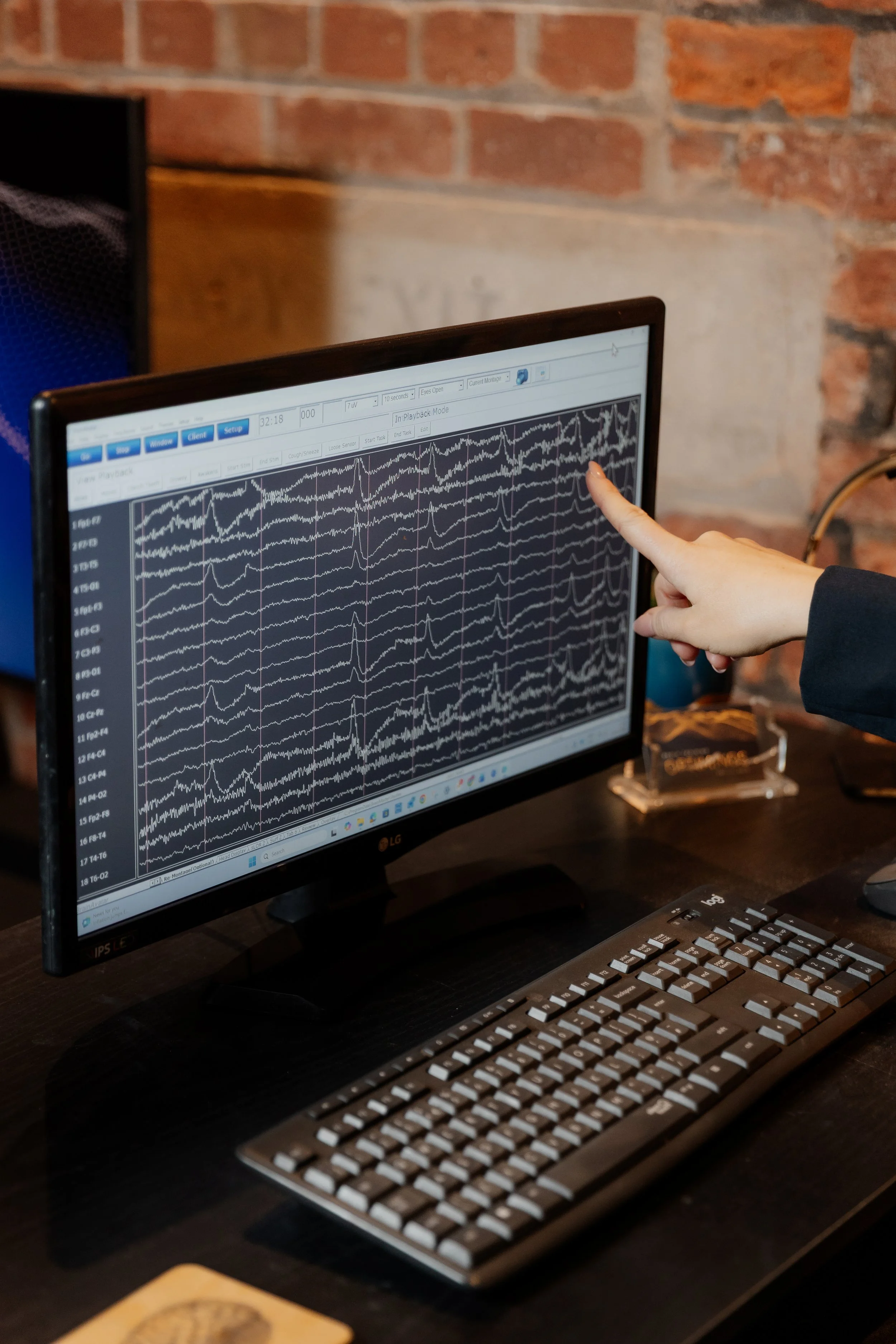 Monitoring live EEG recording at Optiminds
