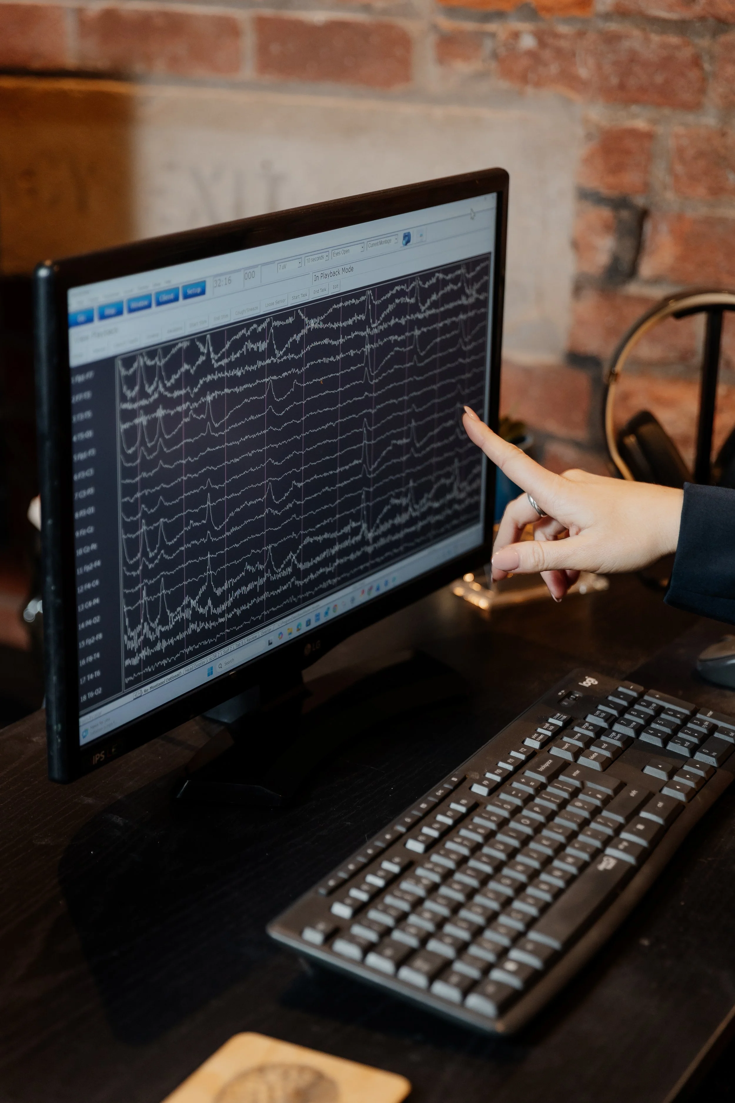 a computer showing live EEG recording with a practitioner pointing to the screen