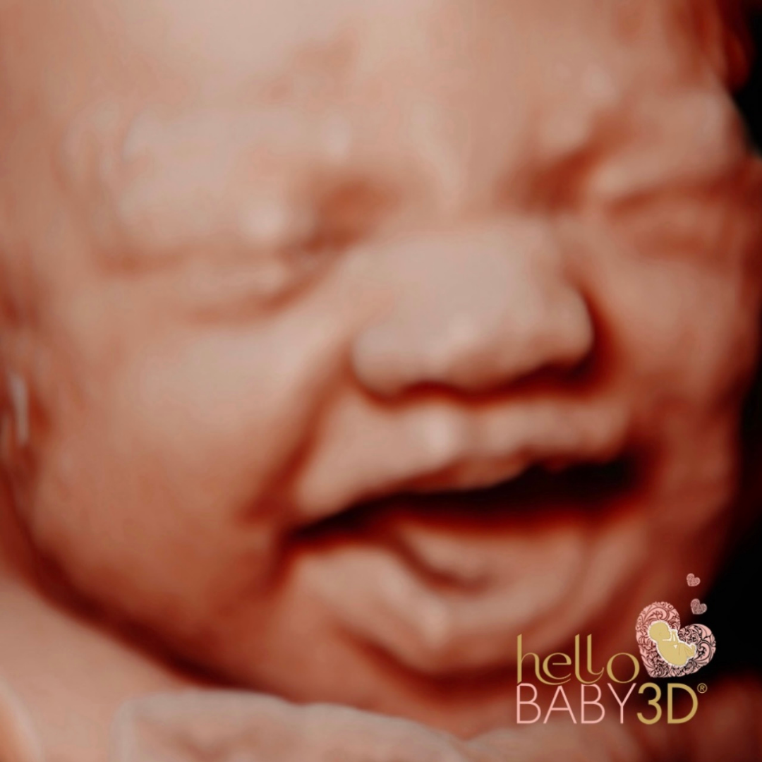 Hello Baby Deluxe 3D Pregnancy Ultrasound (20-40 weeks).png