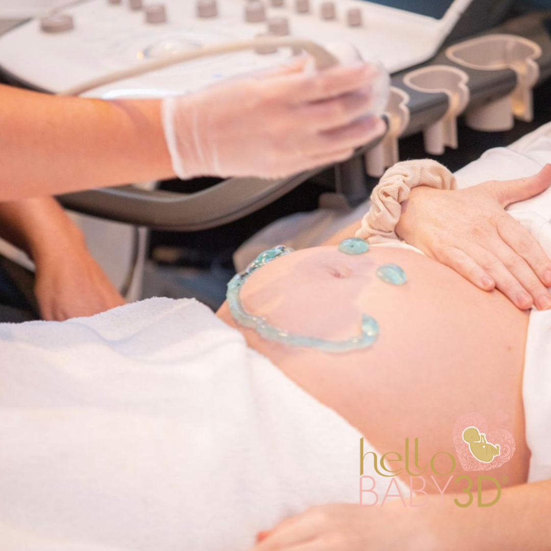 Reassurance 3D Pregnancy Ultrasound (7-13 weeks) (3).png