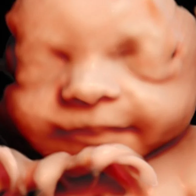 A little lady that looks a lot like daddy! 🥰 #29weeks #pregnant #3dultrasound #smiling #hellobaby3d