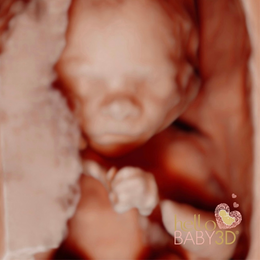 Reassurance 3D Pregnancy Ultrasound (14-19 weeks) (5).png